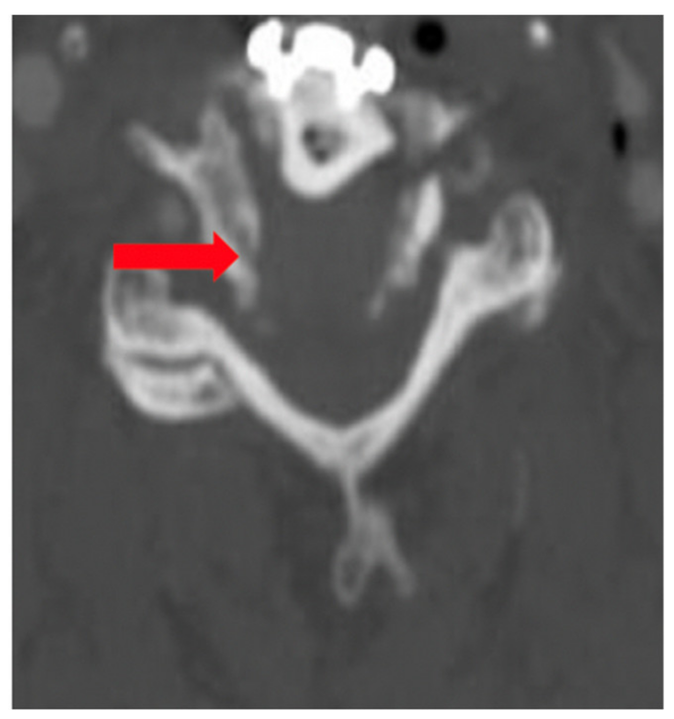Brainsci 09 00345 g002