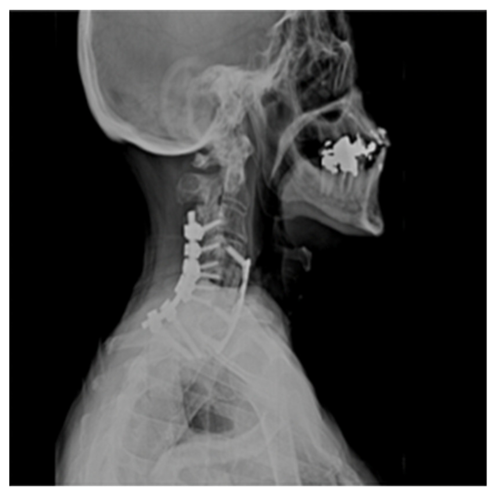 Brainsci 09 00345 g004