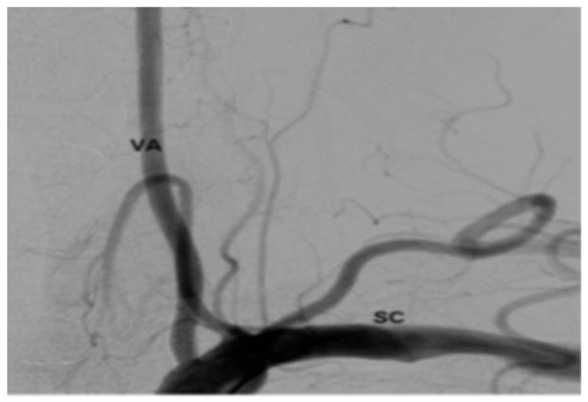 Brainsci 09 00345 g007