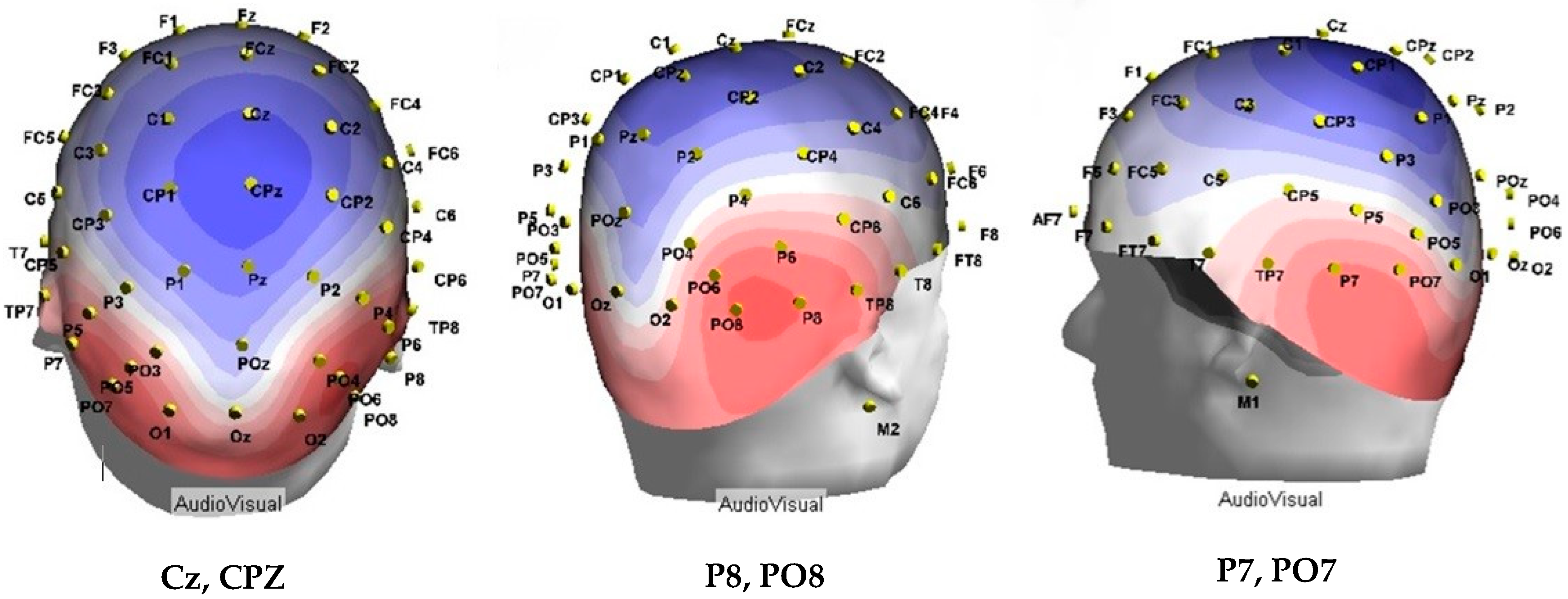 Brainsci 09 00362 g003