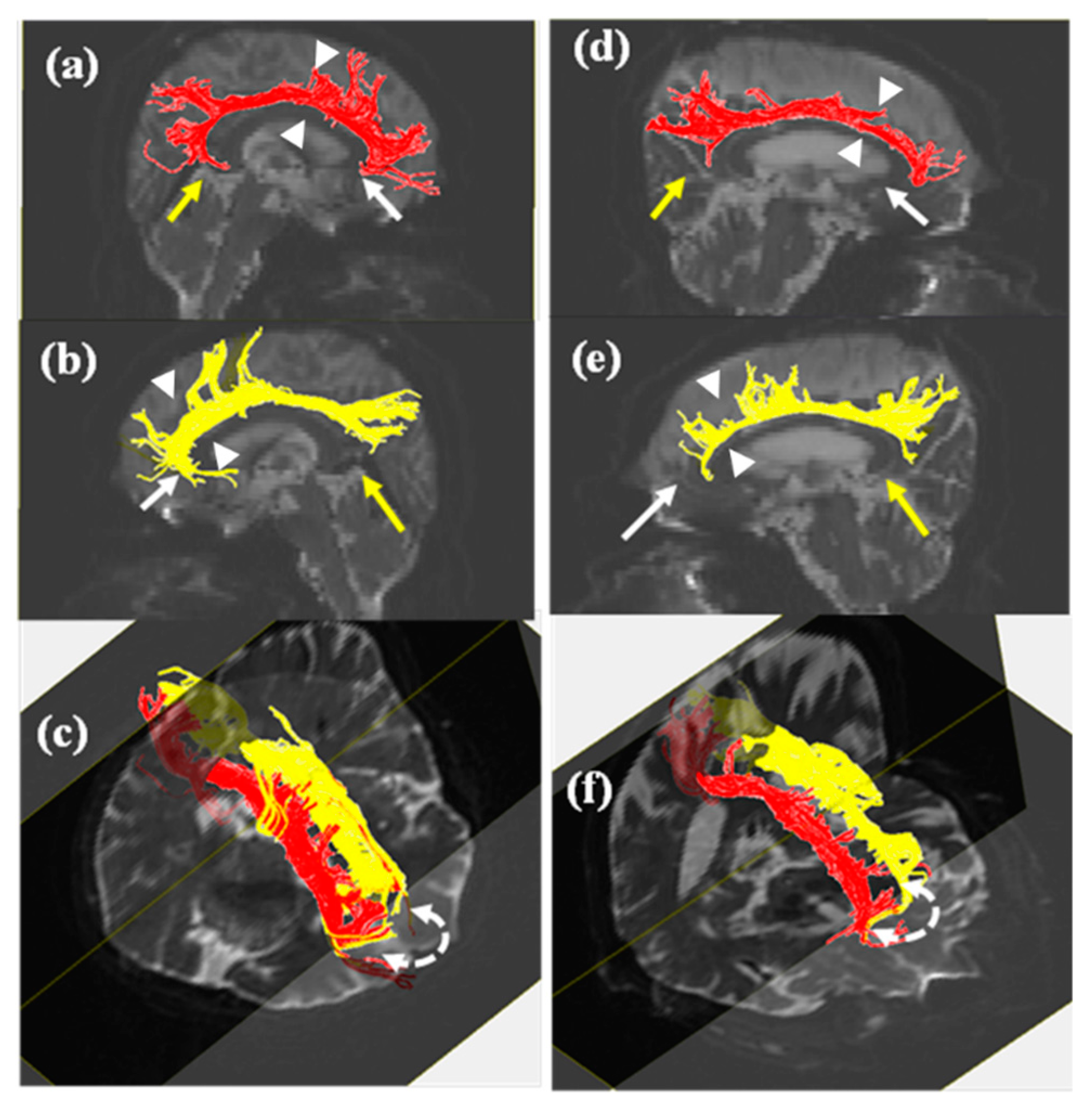 Brainsci 09 00377 g001 Brainsci 09 00377 g001