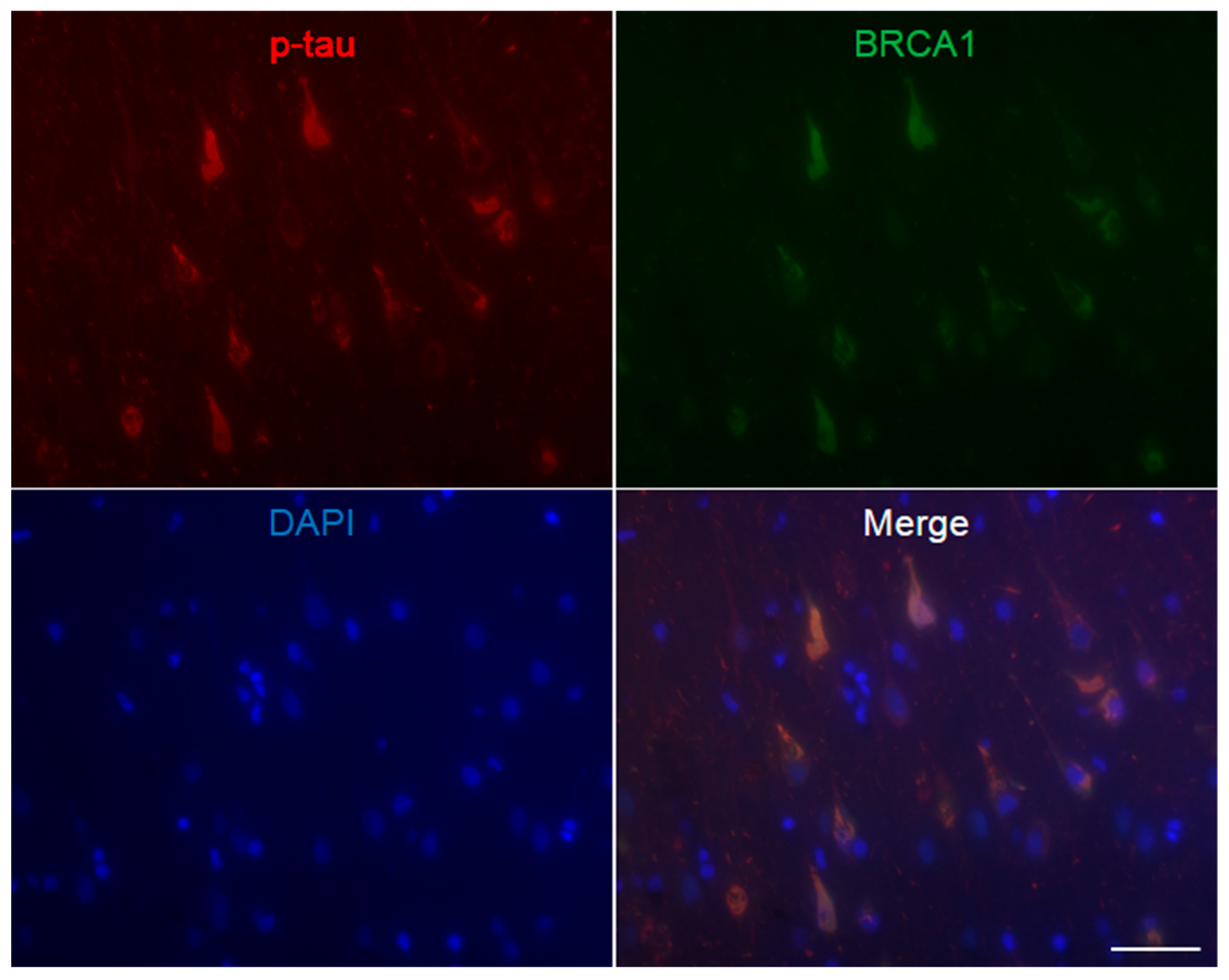 Brainsci 10 00007 g0a3