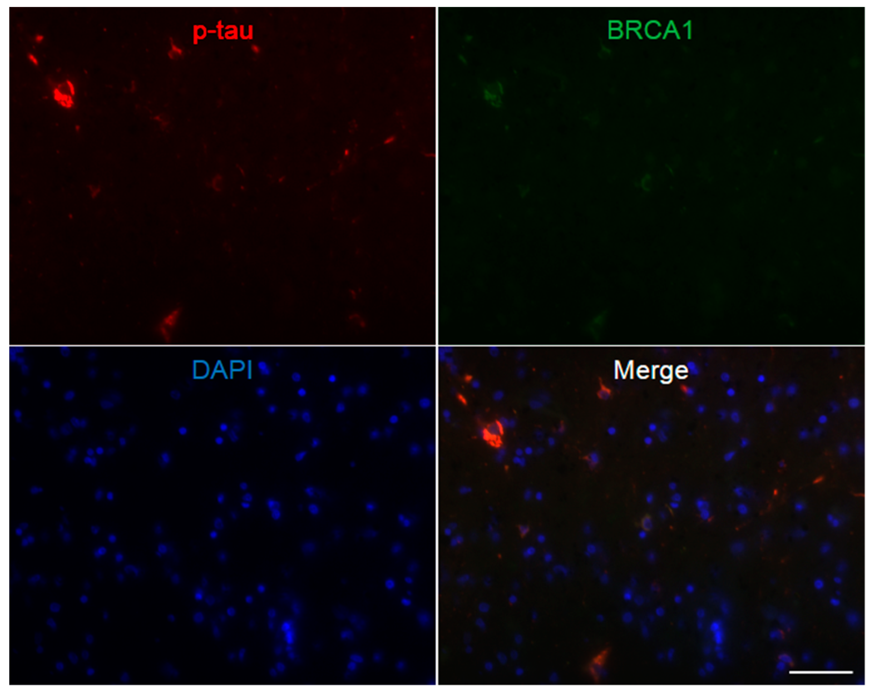 Brainsci 10 00007 g0a5