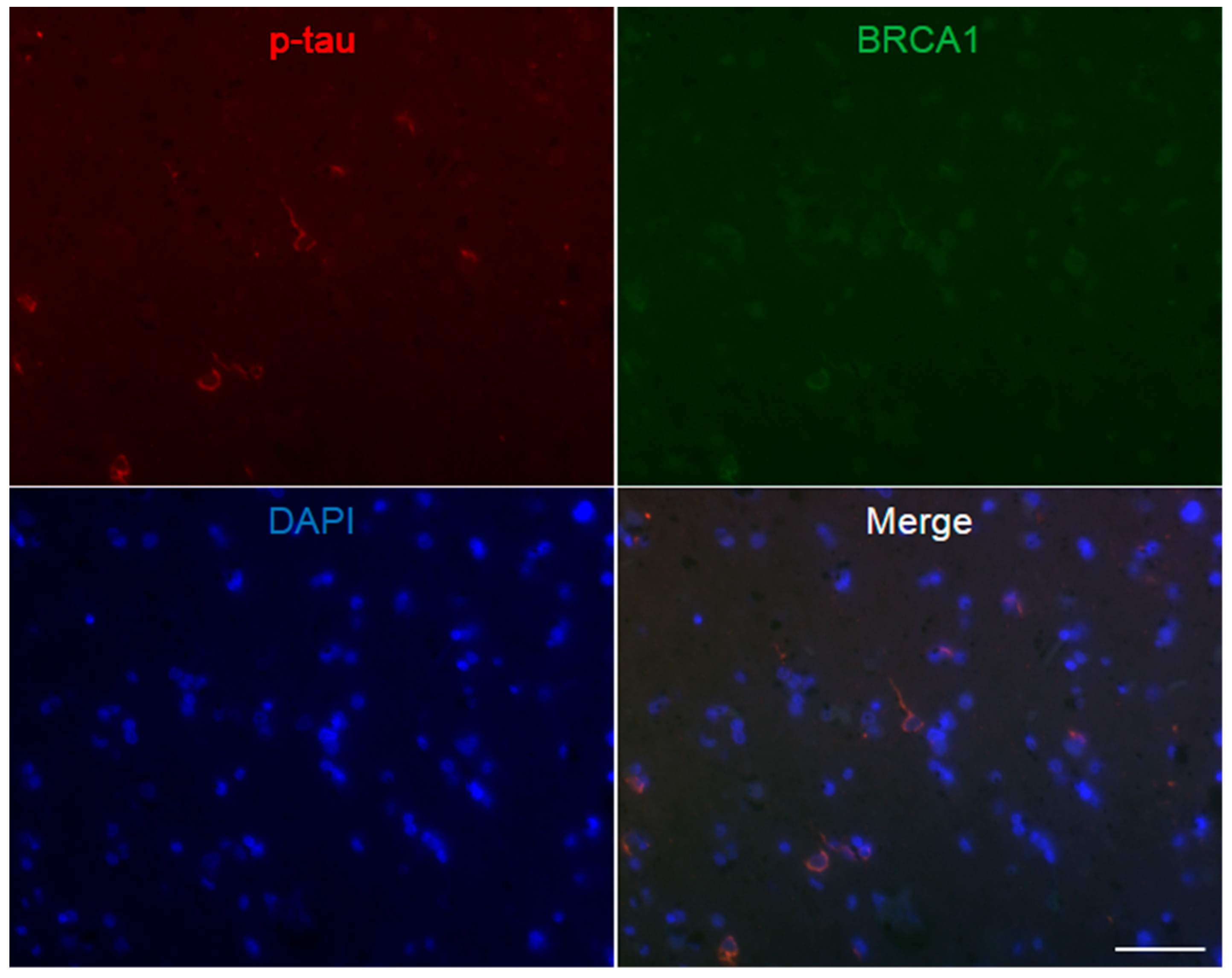 Brainsci 10 00007 g0a6