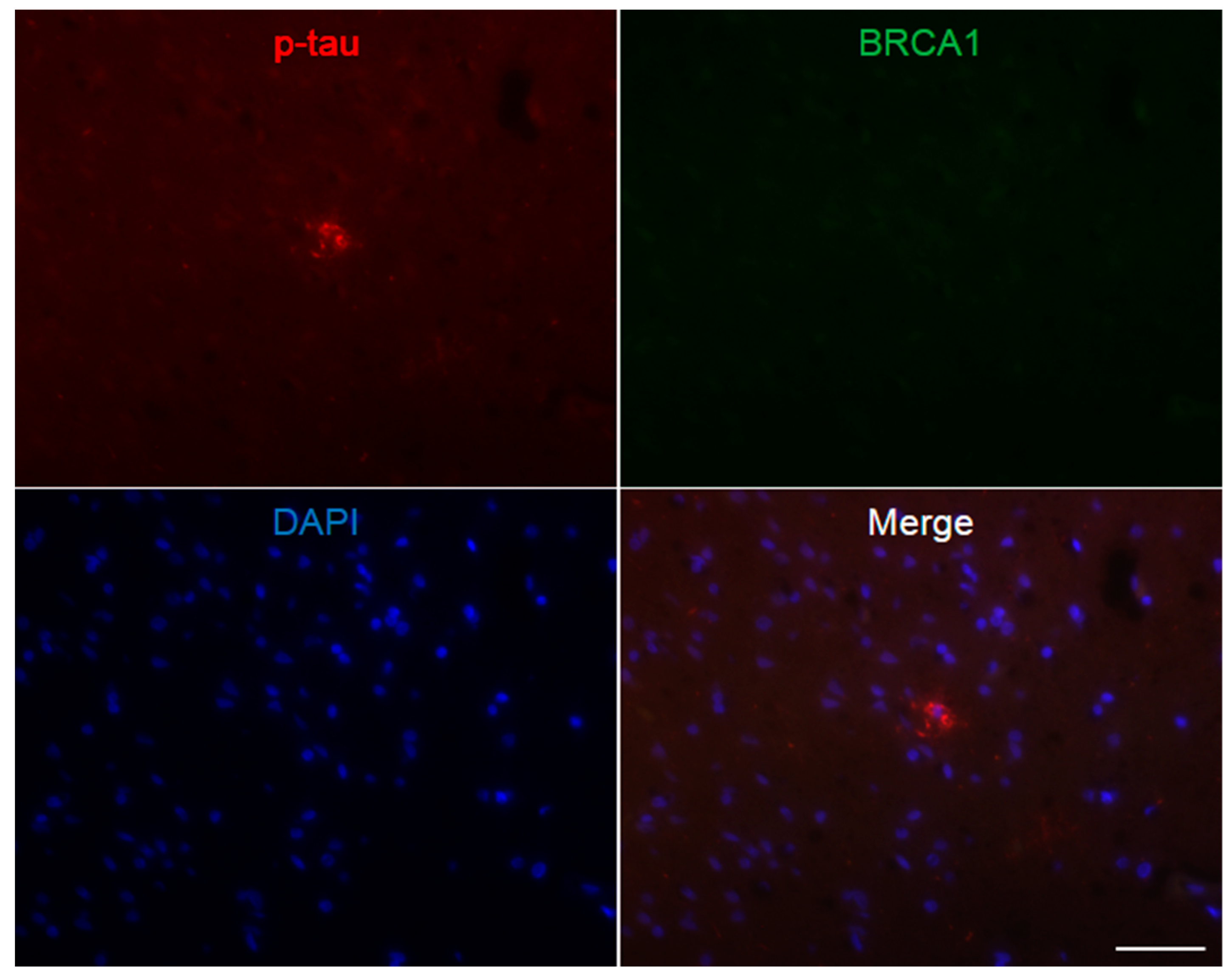Brainsci 10 00007 g0a7