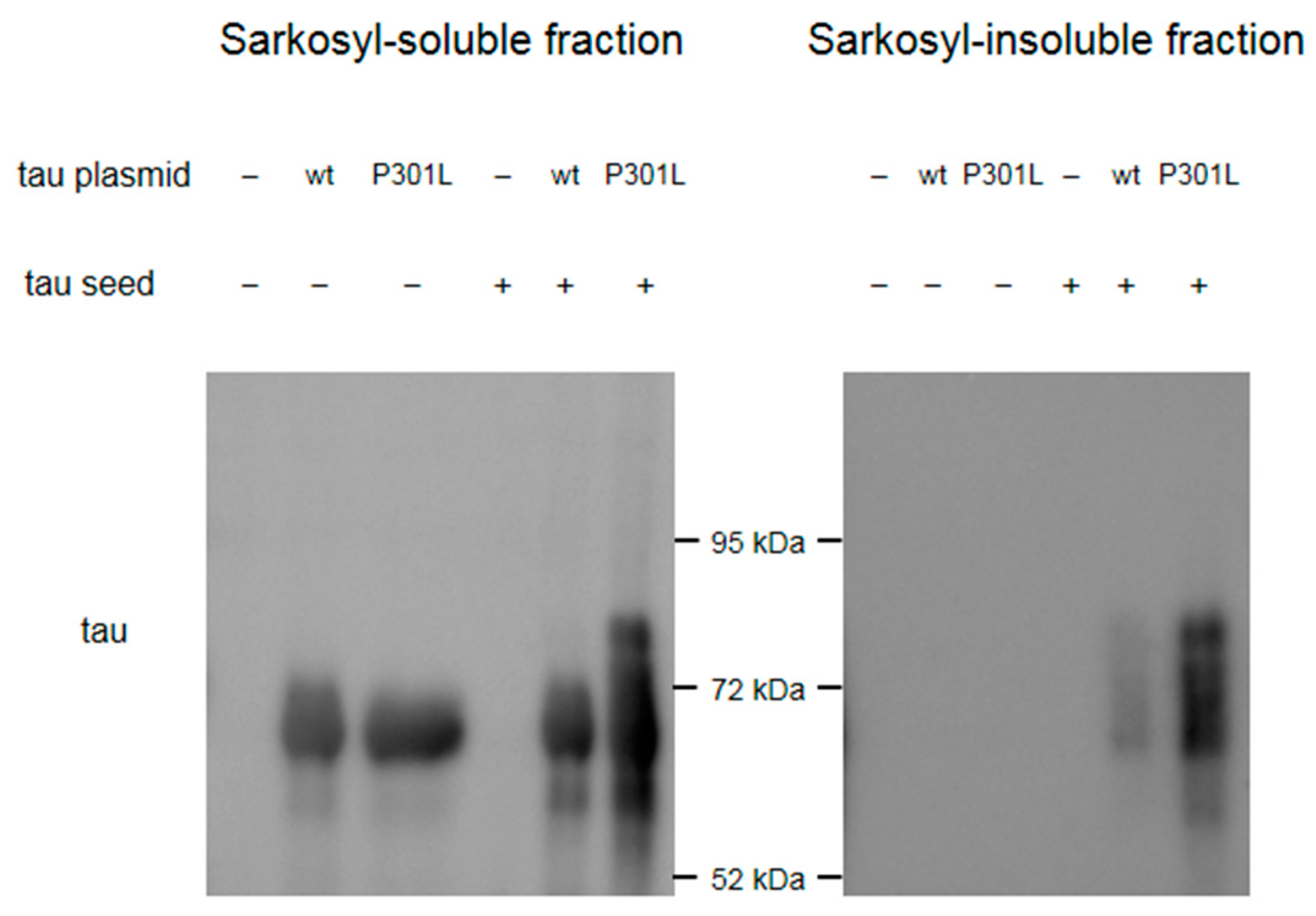Brainsci 10 00007 g0a8