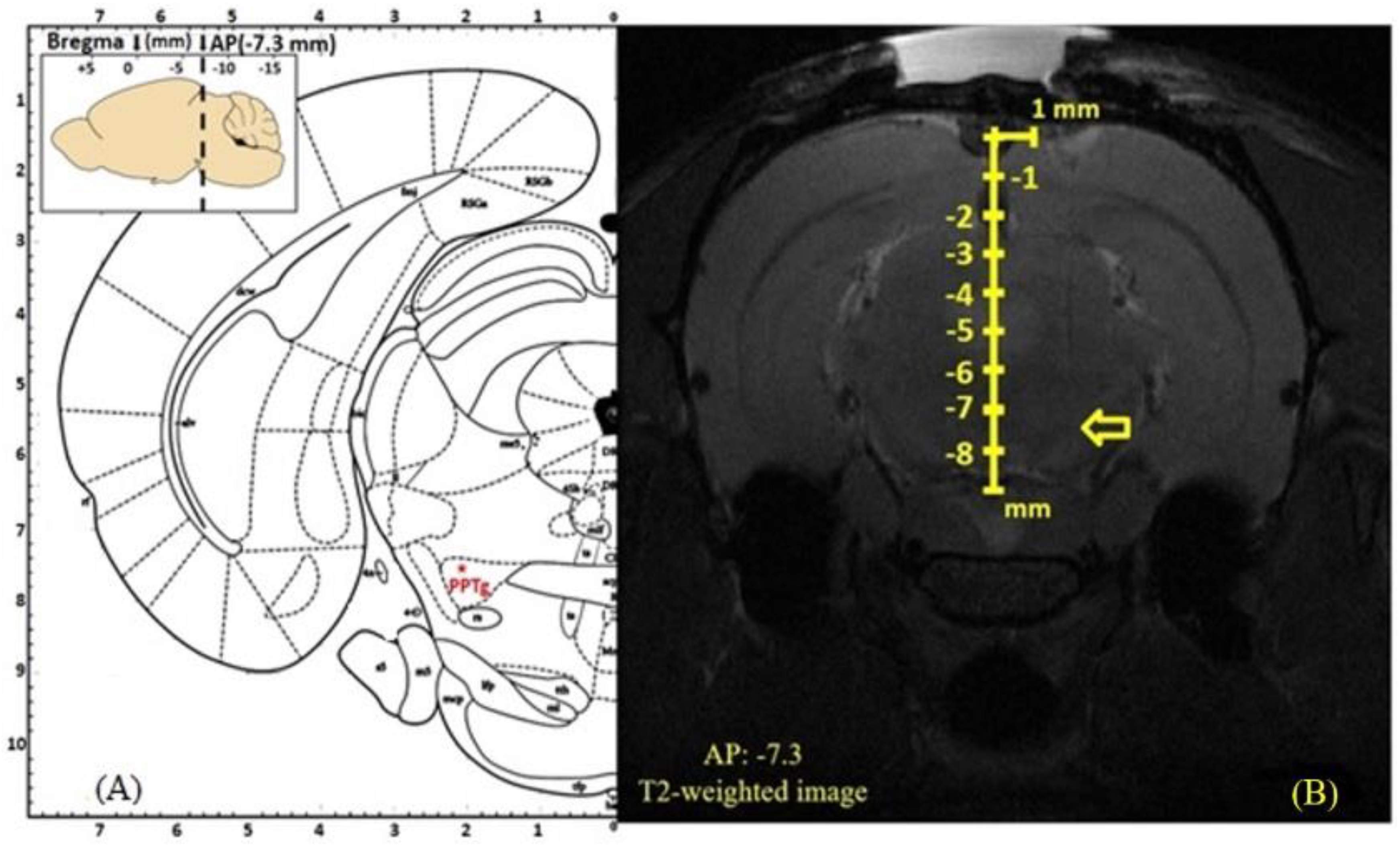 Brainsci 10 00025 g001