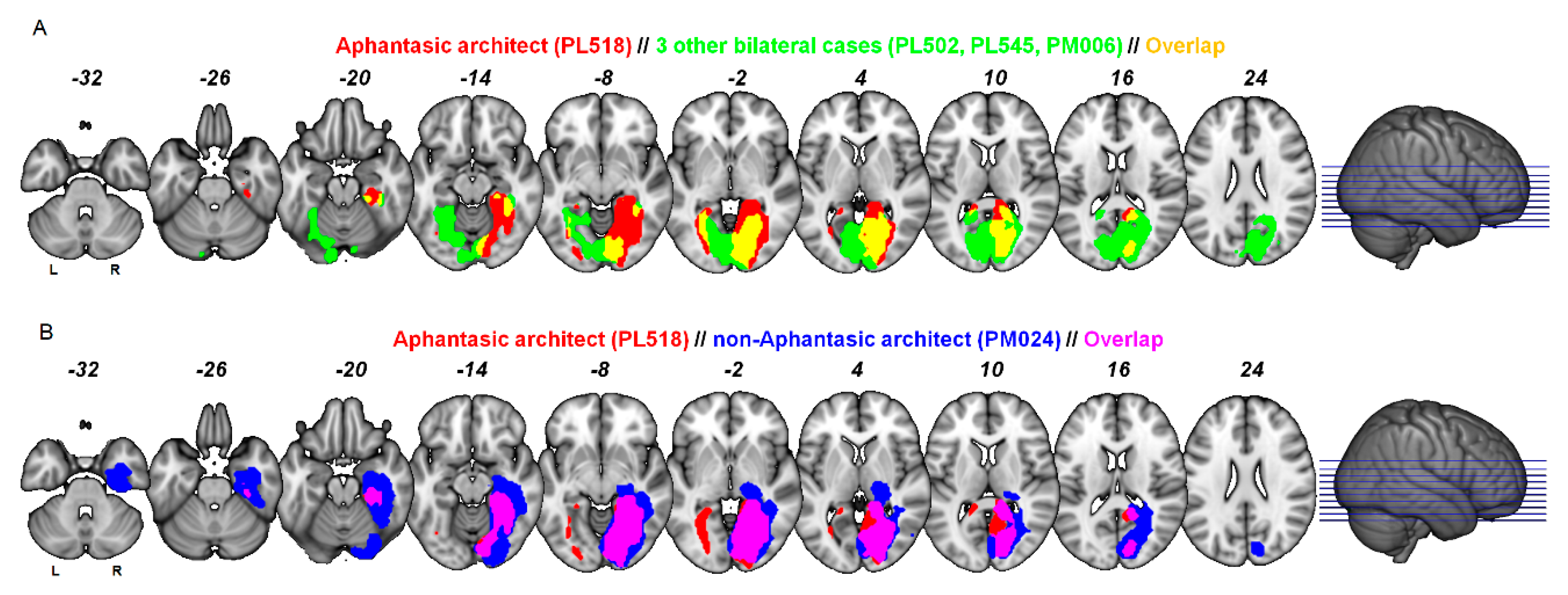 types of imagery of brain