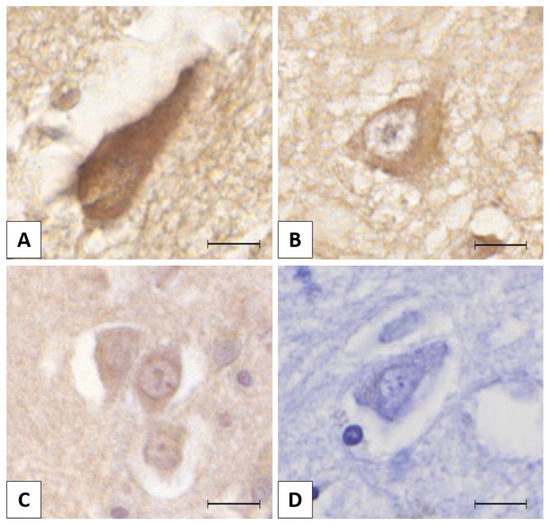 Brain Sciences Free FullText Lemur Tyrosine Kinase 2