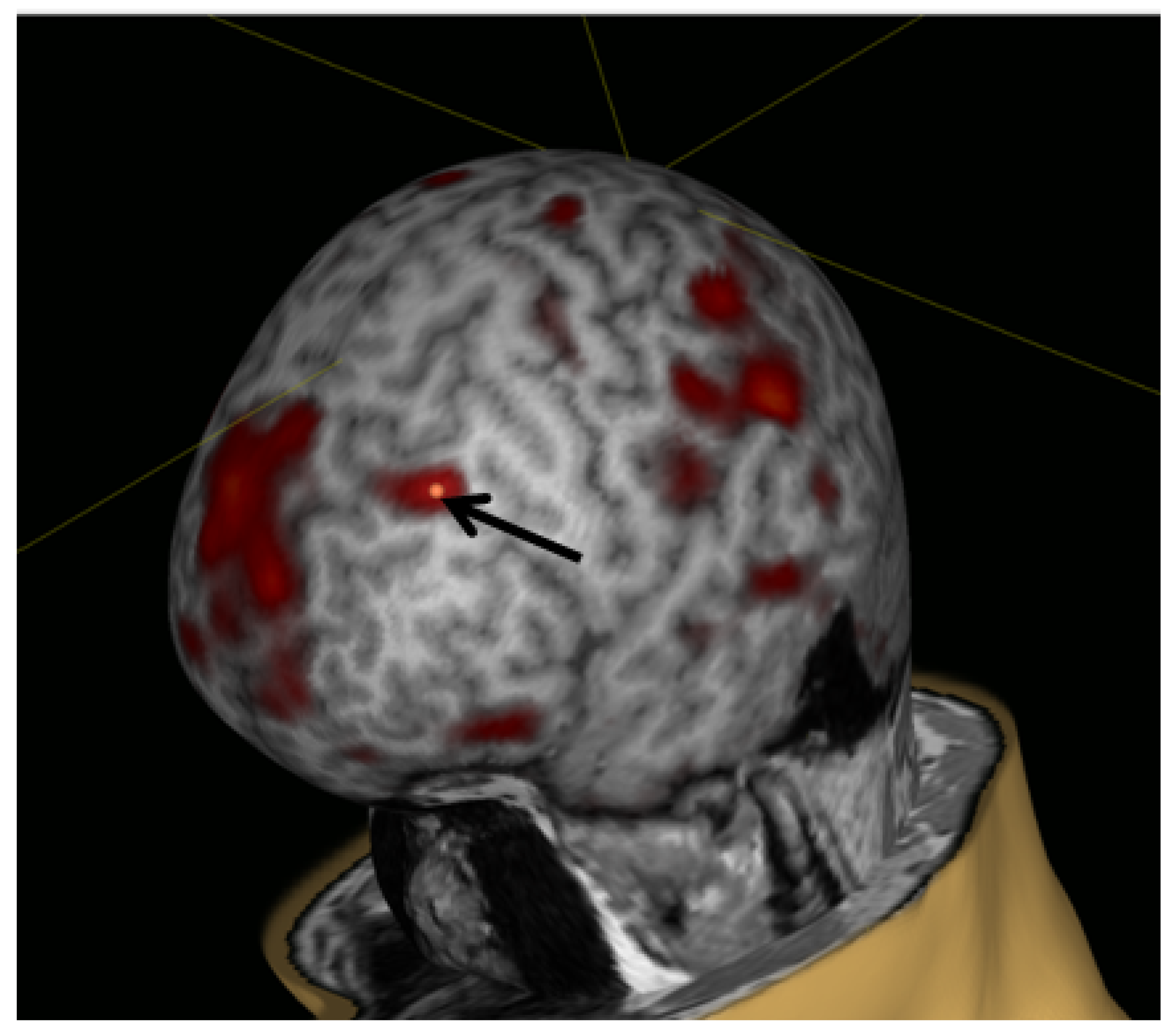 Brainsci 10 00083 g003