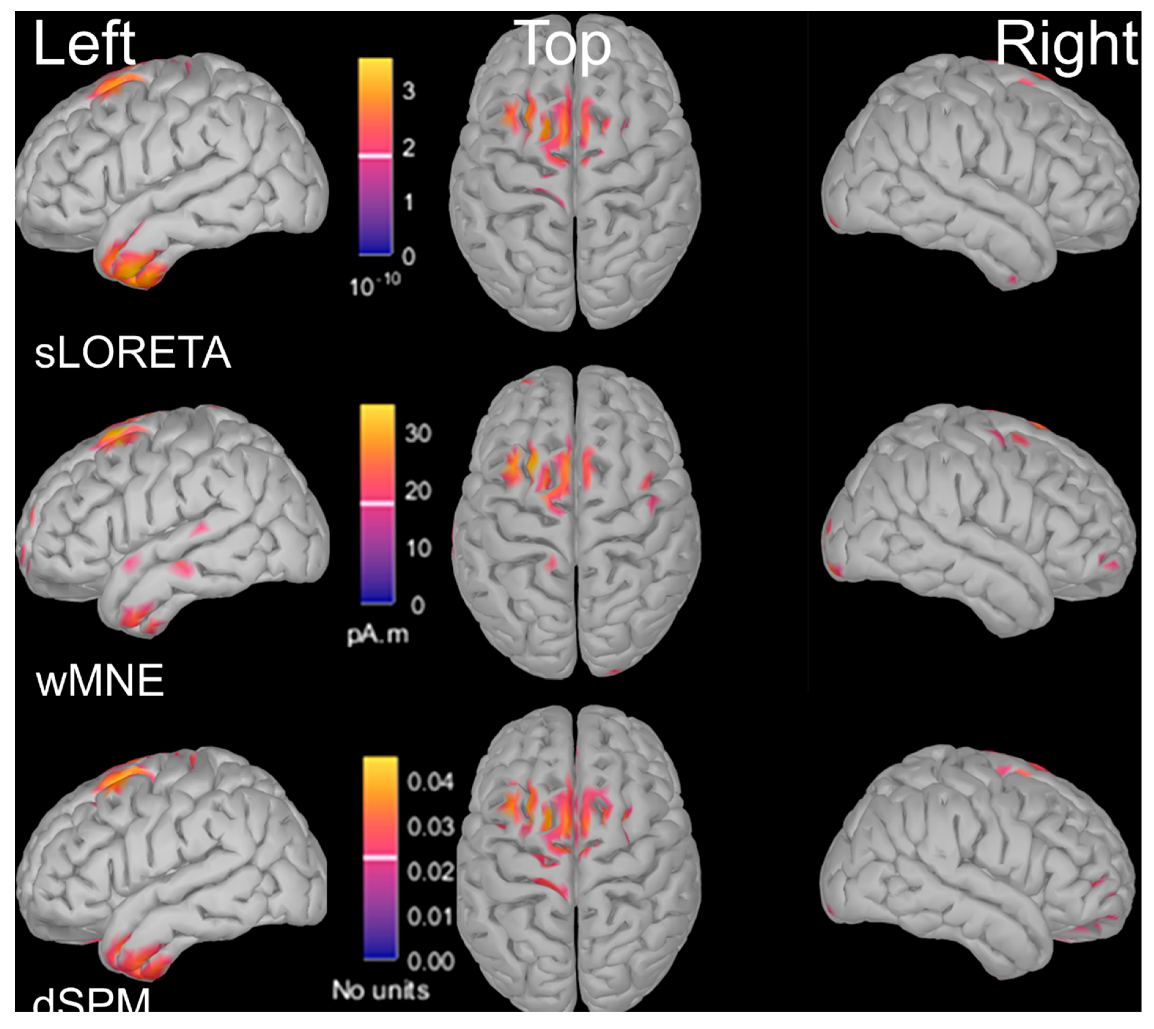 Cortical Oscillations during Gait: Wouldn't Walking Be So