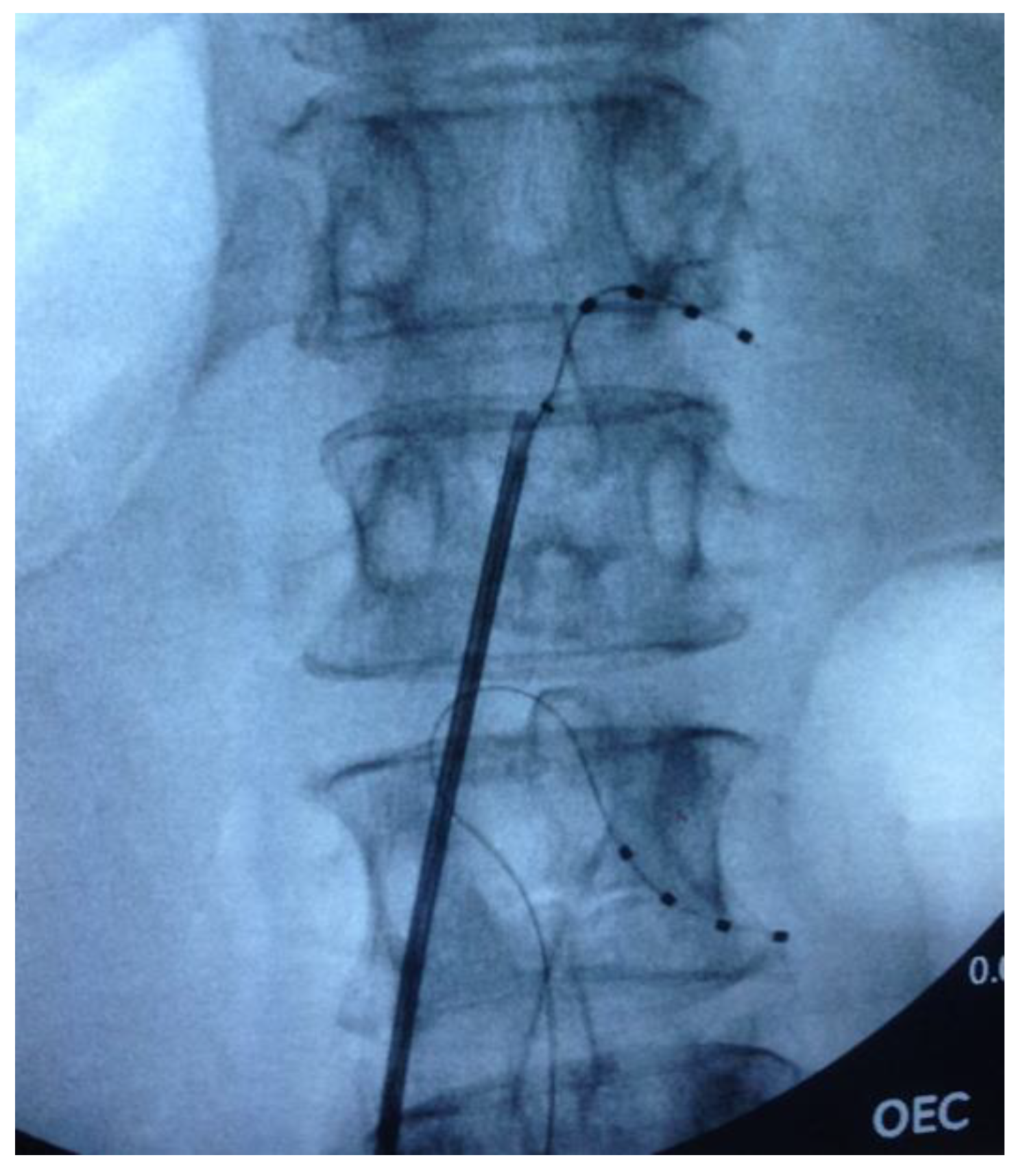 Brainsci 10 00095 g001 Brainsci 10 00095 g001