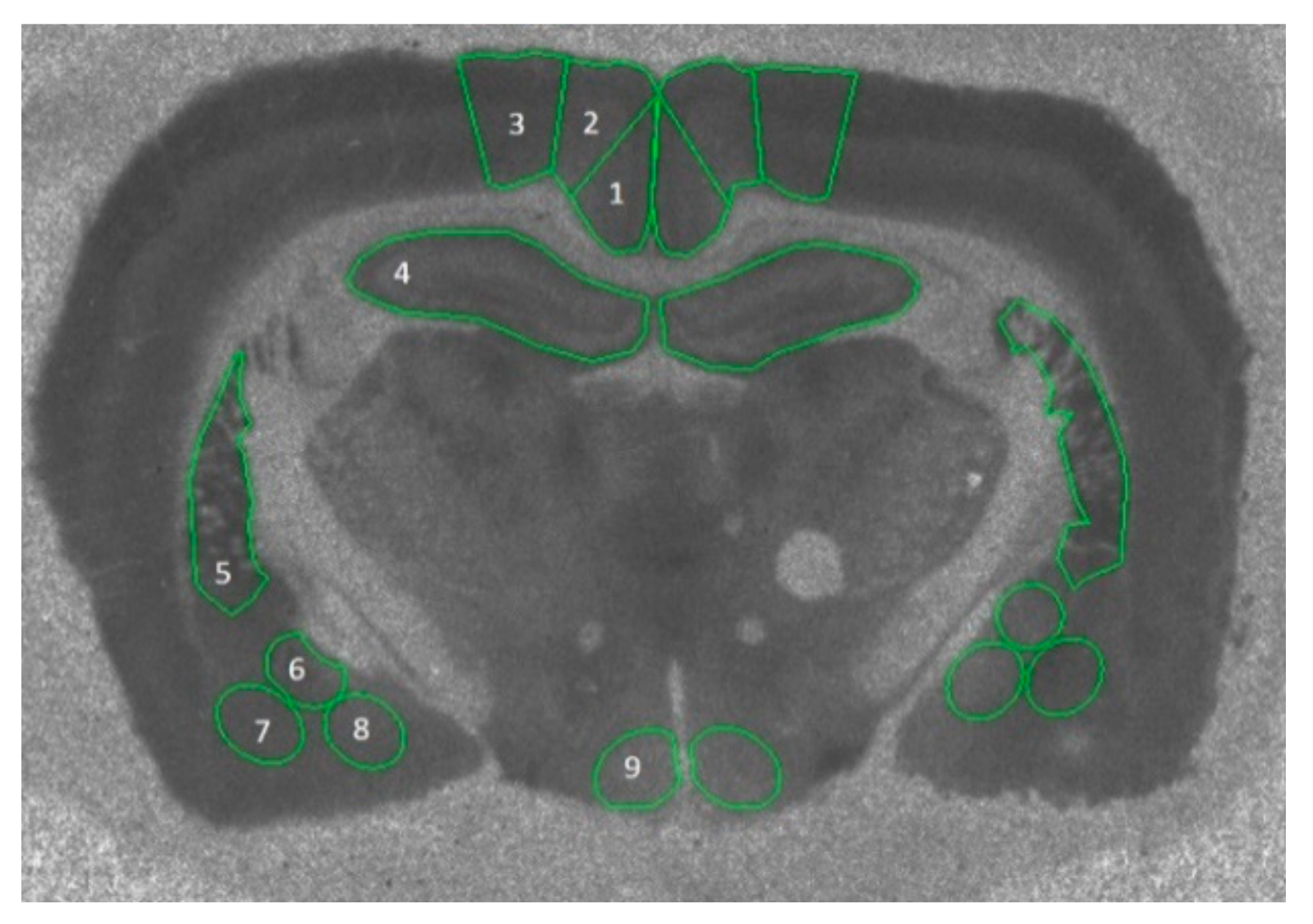 Brainsci 10 00106 g001 Brainsci 10 00106 g001