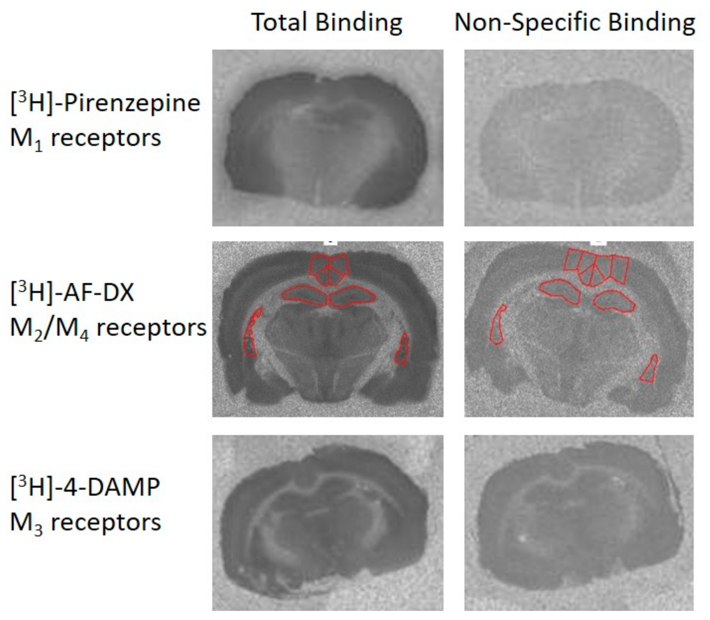 Brainsci 10 00106 g002 Brainsci 10 00106 g002