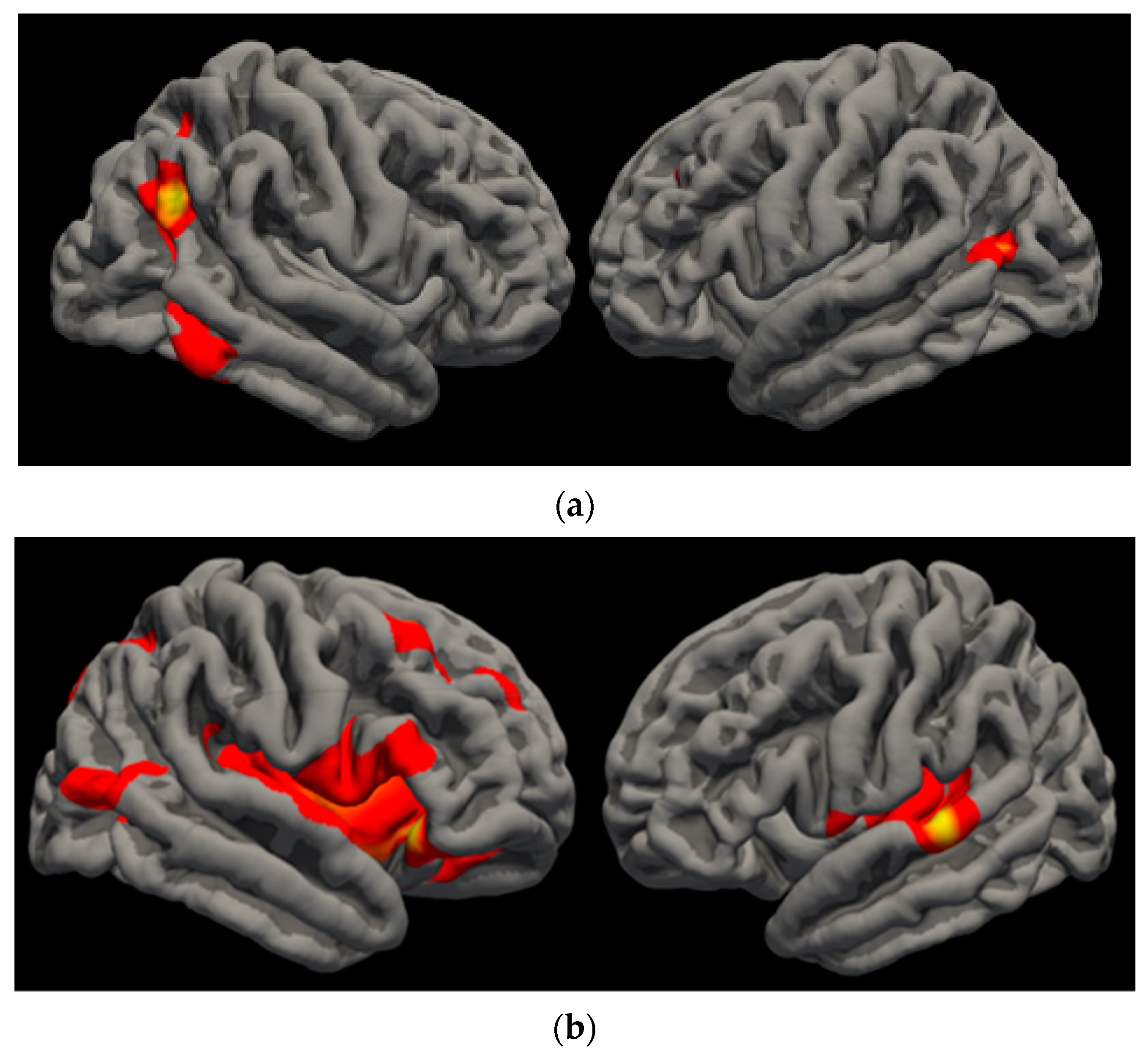 Brainsci 10 00117 g003
