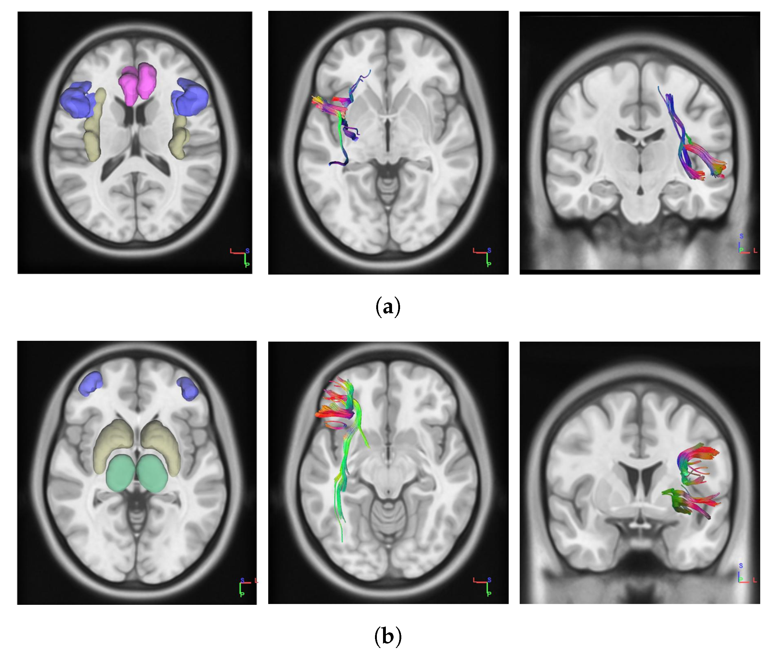 Brainsci 10 00138 g001 Brainsci 10 00138 g001