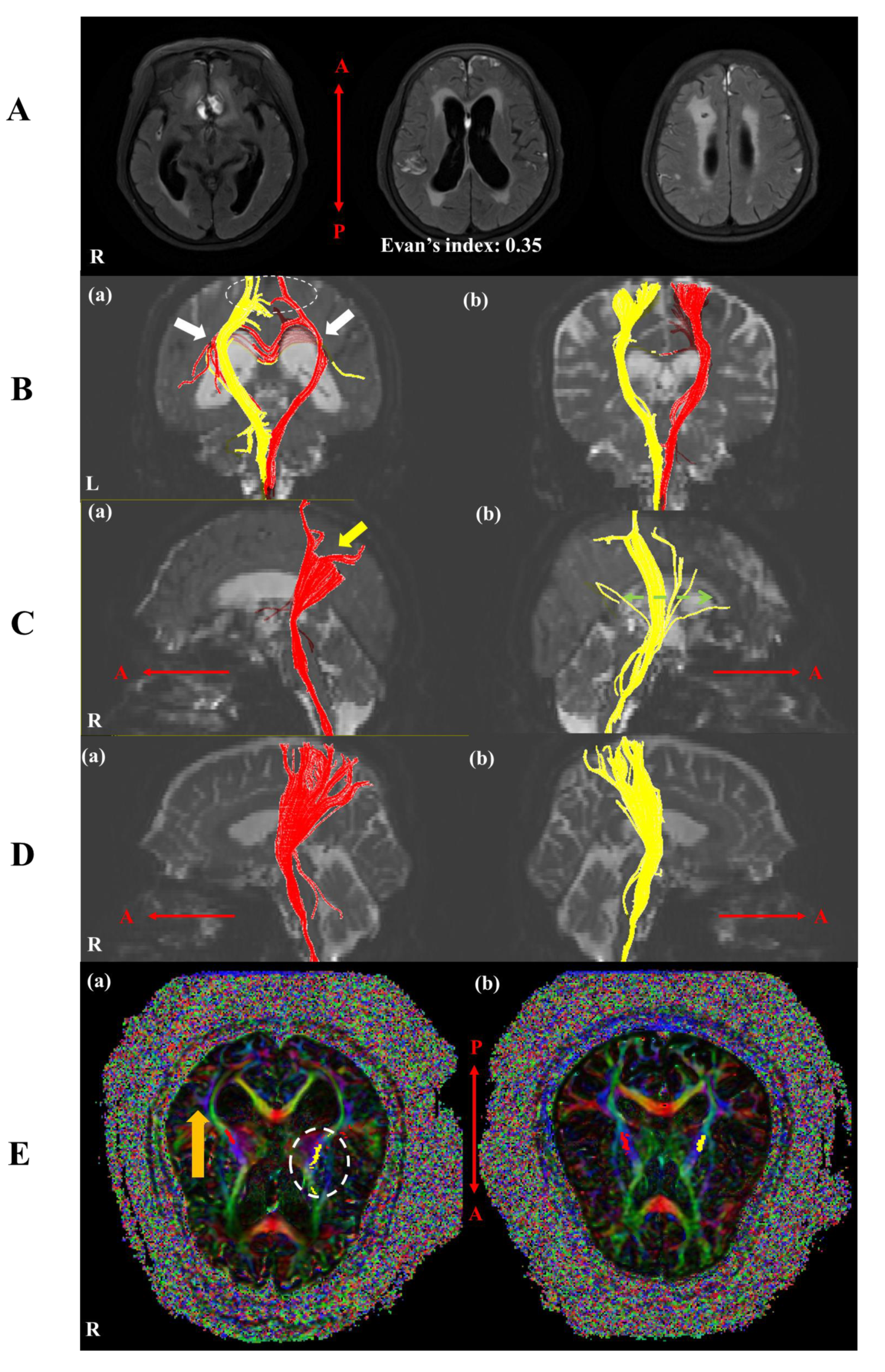 Brainsci 10 00177 g002 Brainsci 10 00177 g002