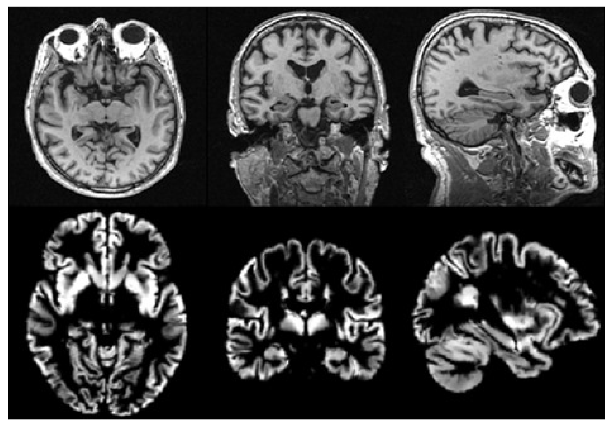 Brainsci 10 00181 g002