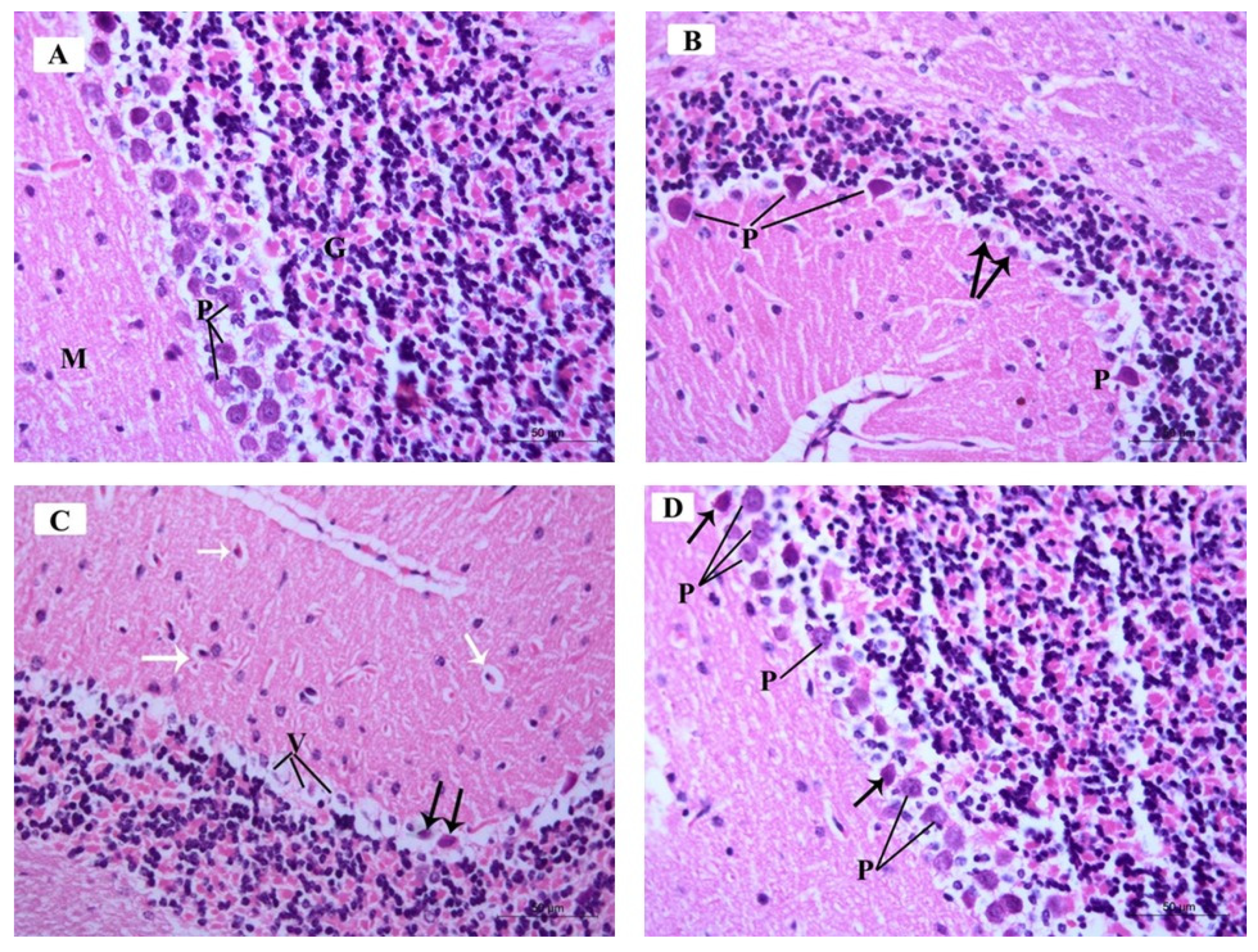 Brainsci 10 00193 g009