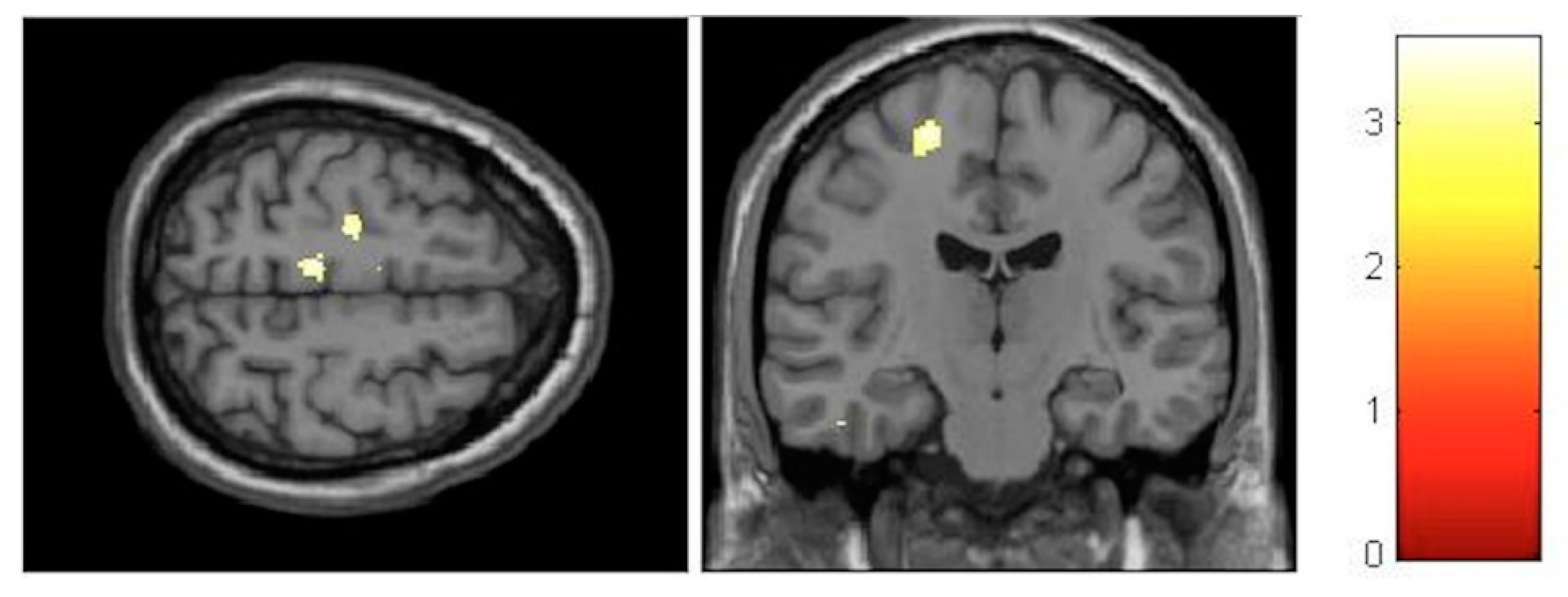 Brainsci 10 00210 g004 Brainsci 10 00210 g004