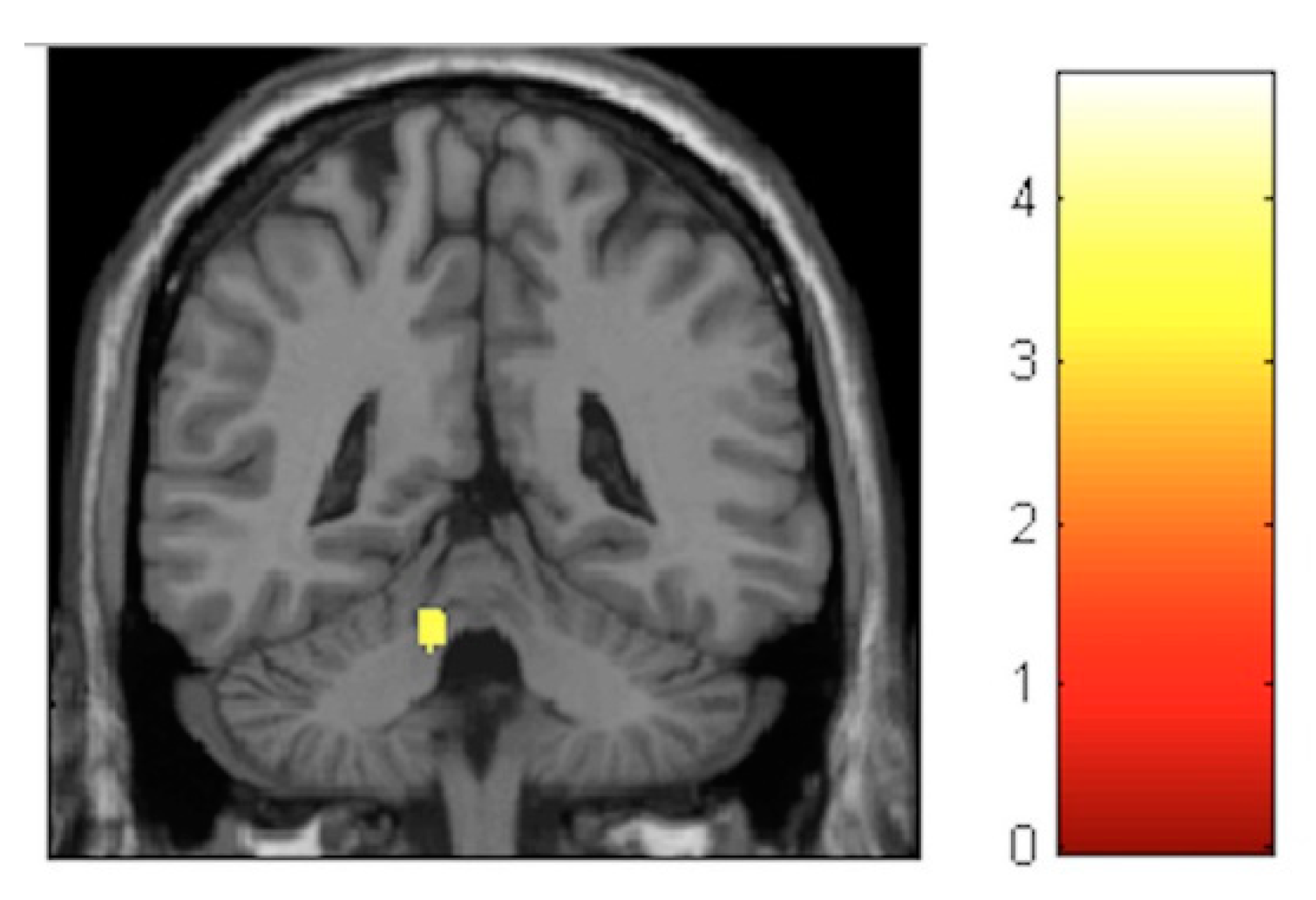 Brainsci 10 00210 g005 Brainsci 10 00210 g005