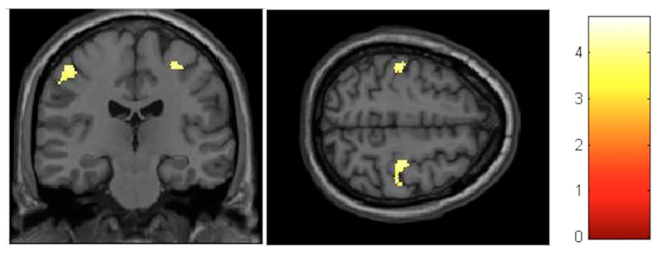 Brainsci 10 00210 g006 Brainsci 10 00210 g006