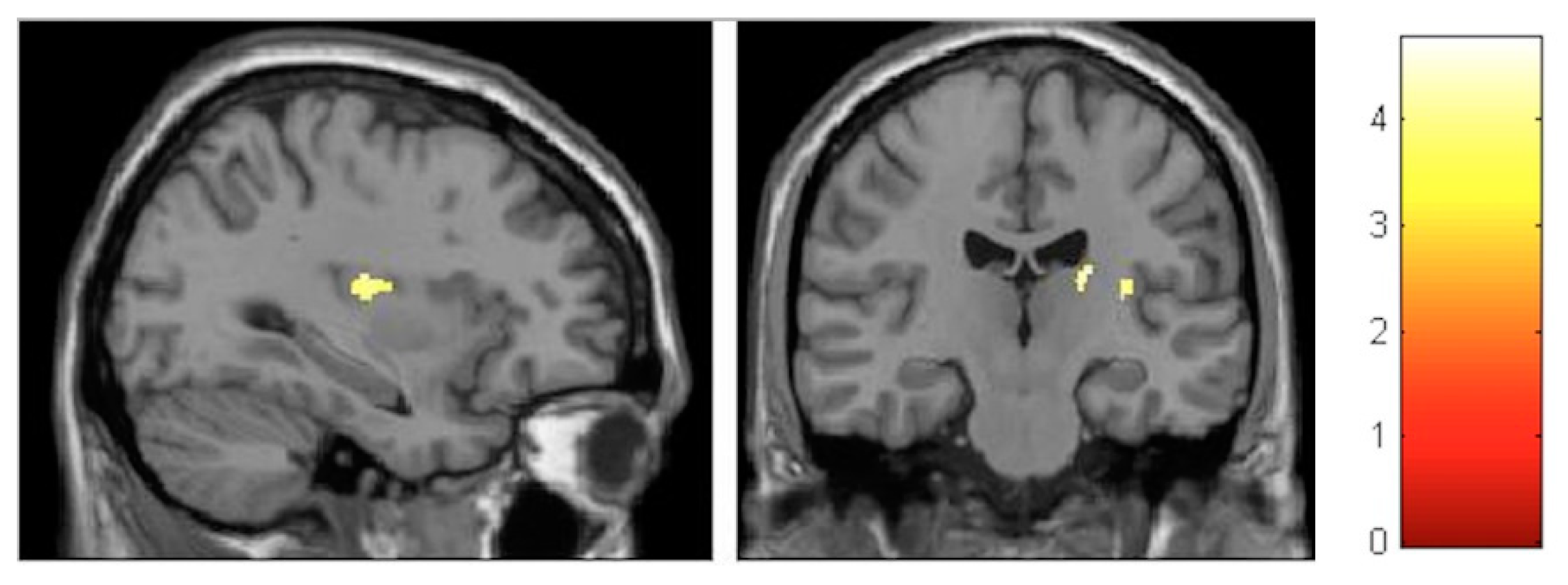 Brainsci 10 00210 g007 Brainsci 10 00210 g007