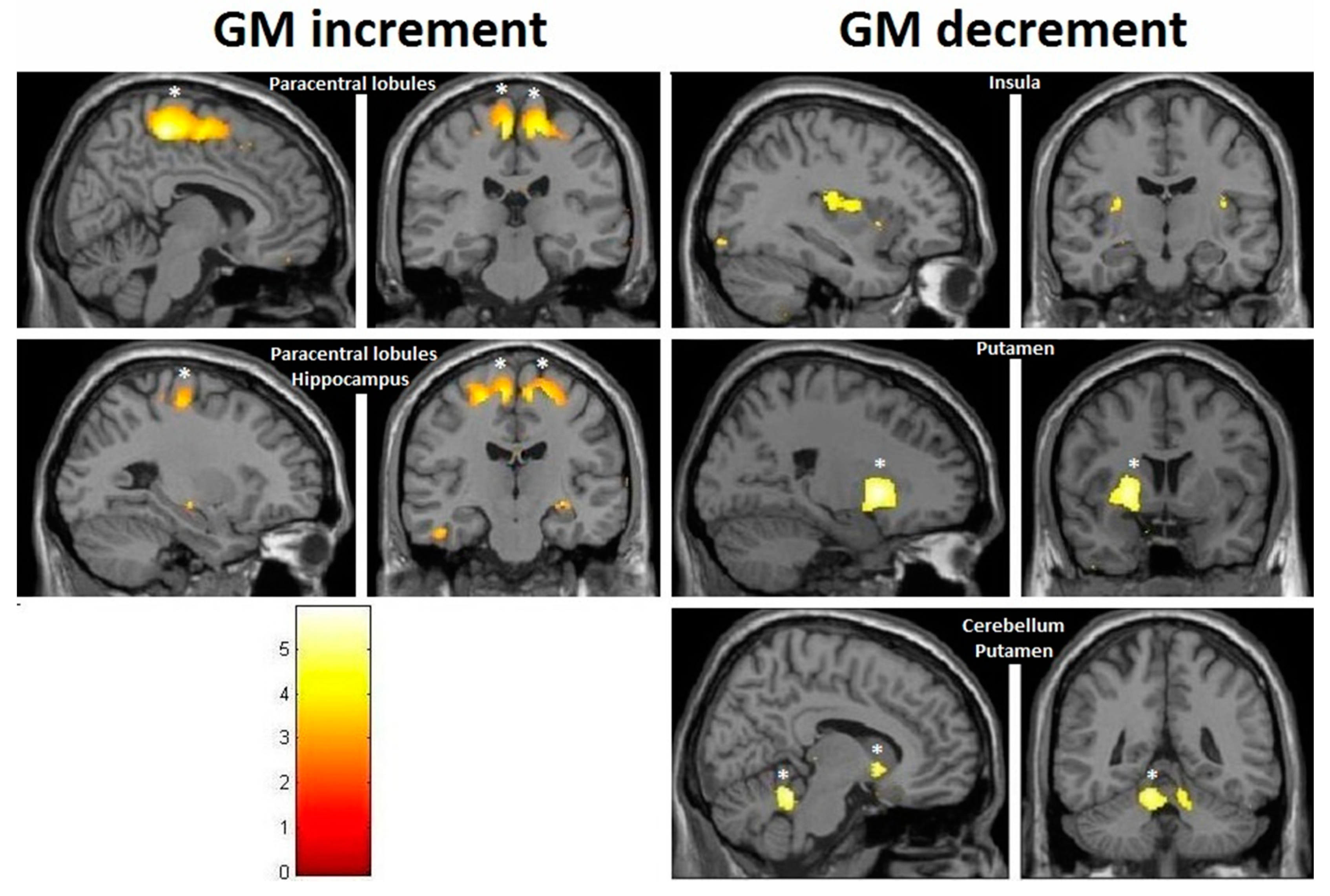 Brainsci 10 00210 g008 Brainsci 10 00210 g008