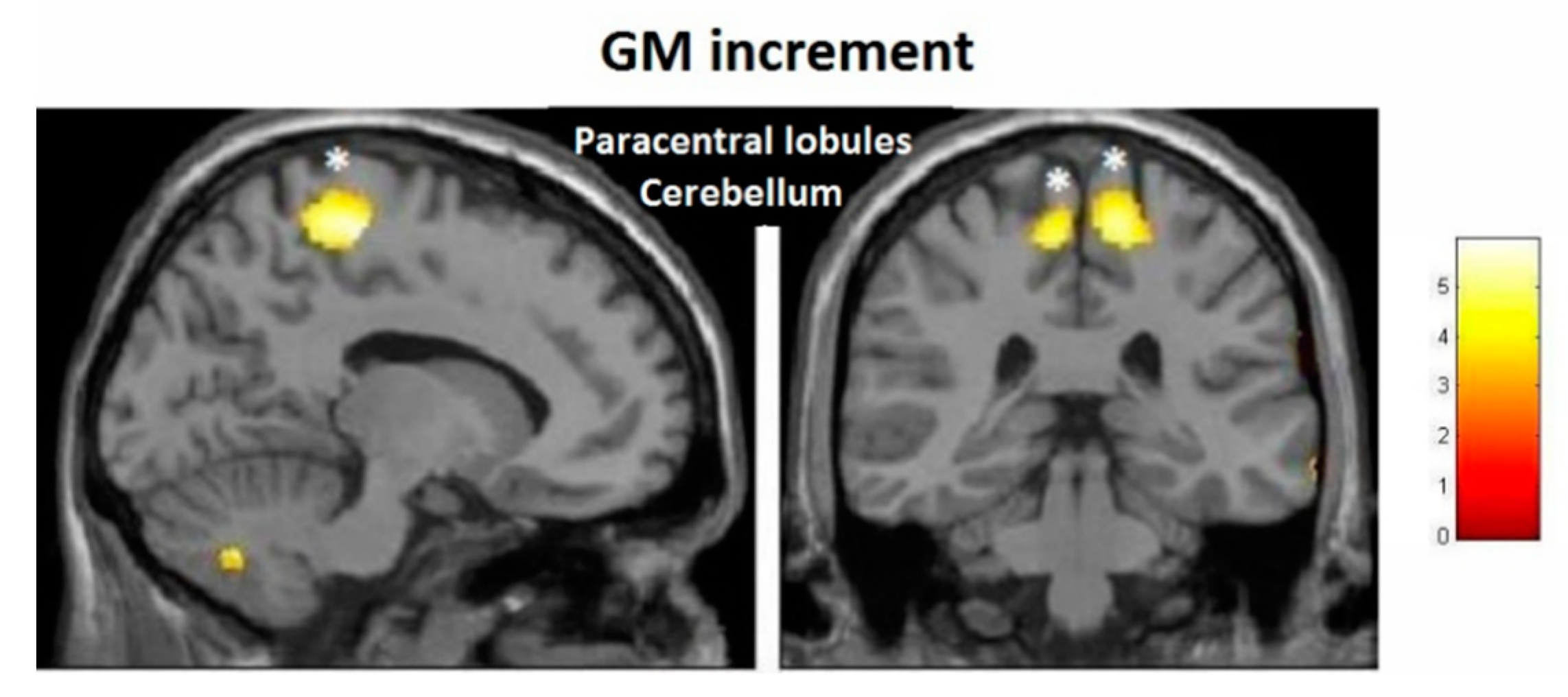 Brainsci 10 00210 g010 Brainsci 10 00210 g010
