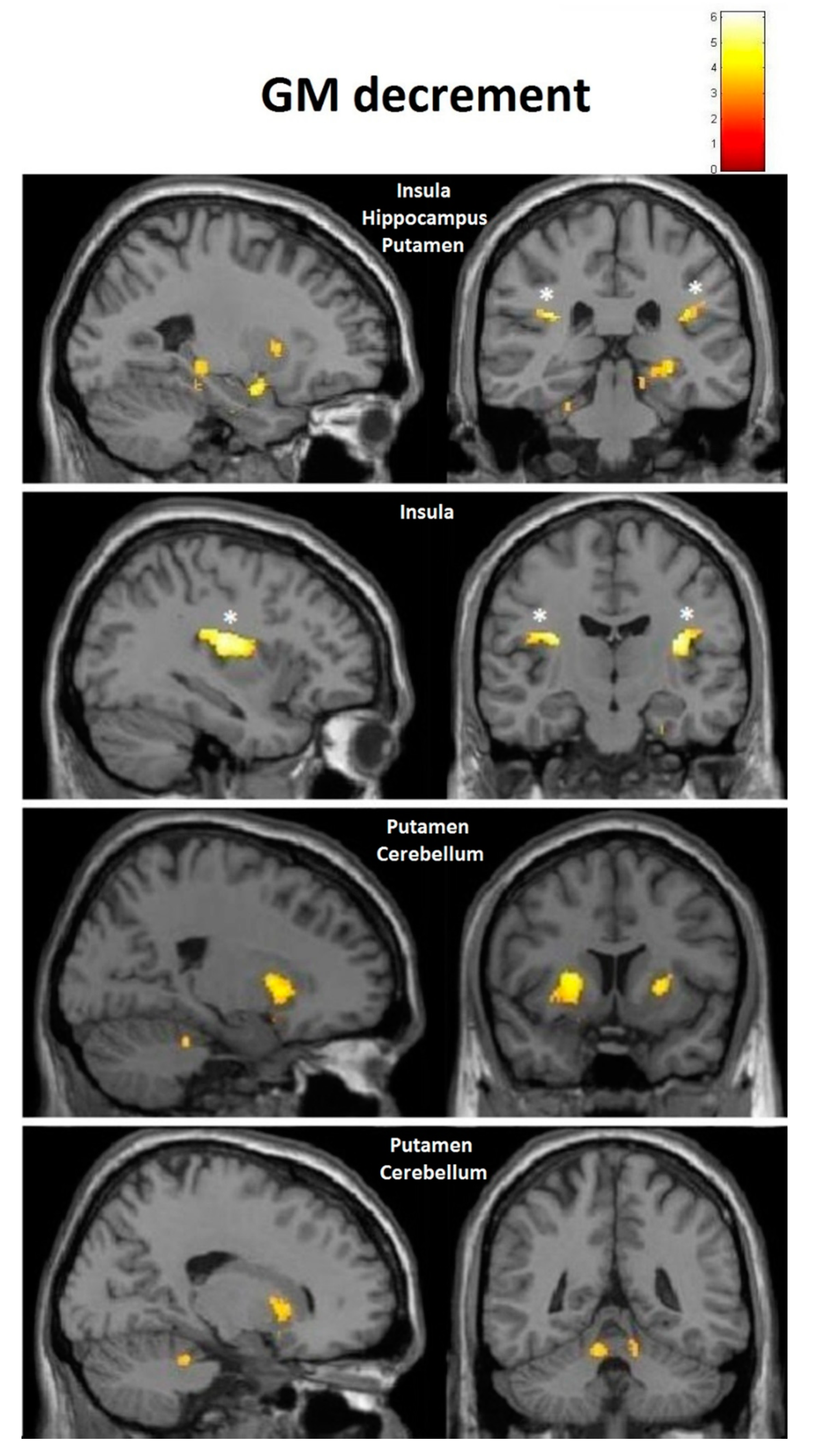 Brainsci 10 00210 g011 Brainsci 10 00210 g011