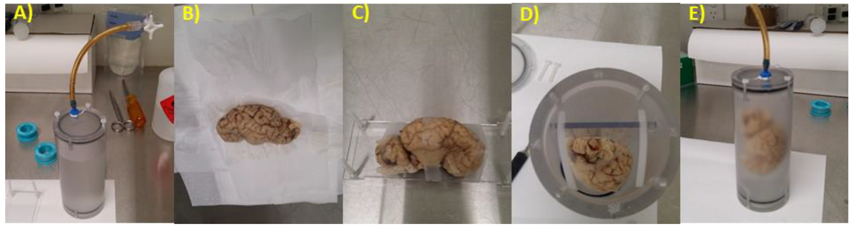 Brainsci 10 00211 g001