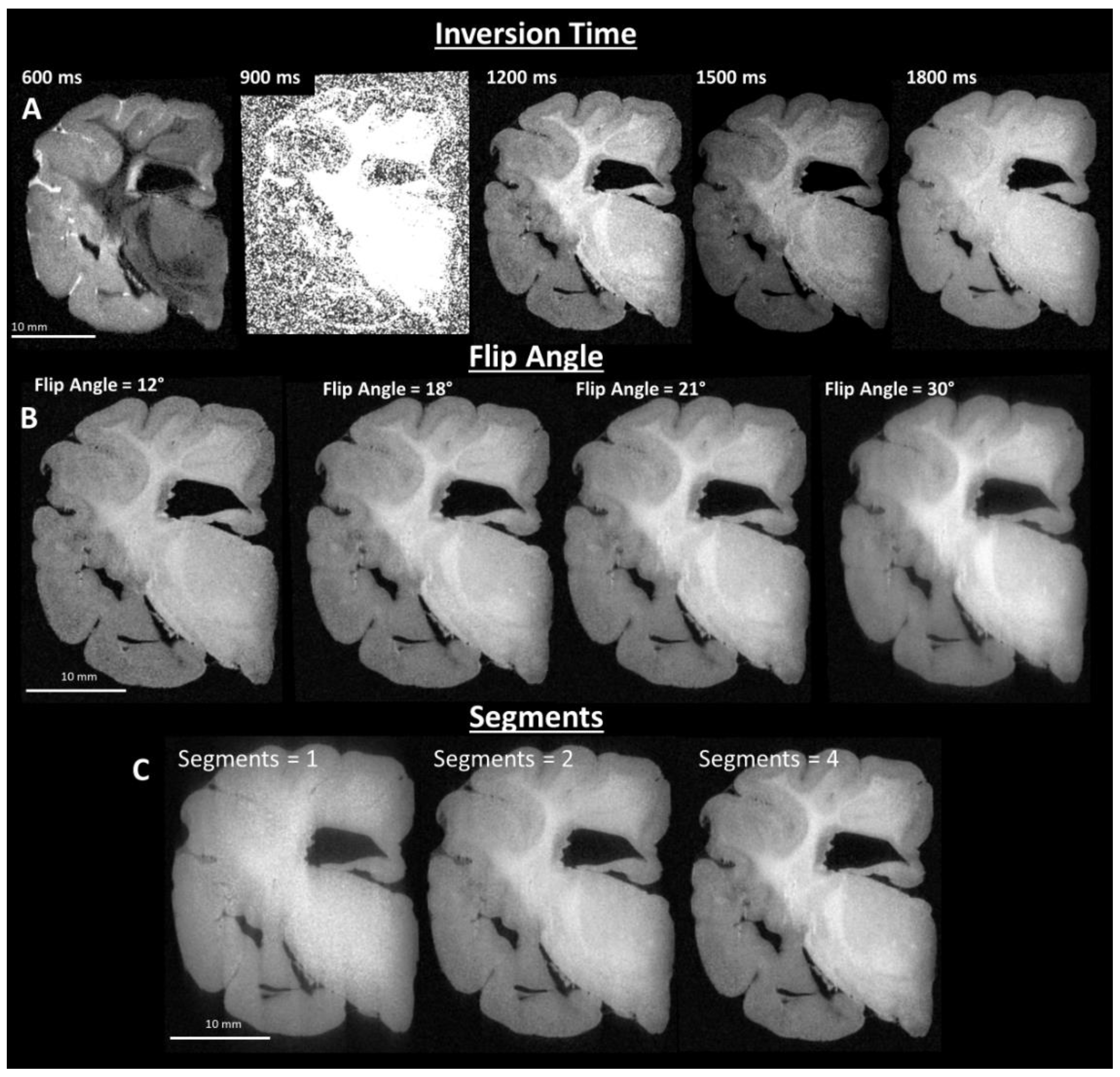 Brainsci 10 00211 g002
