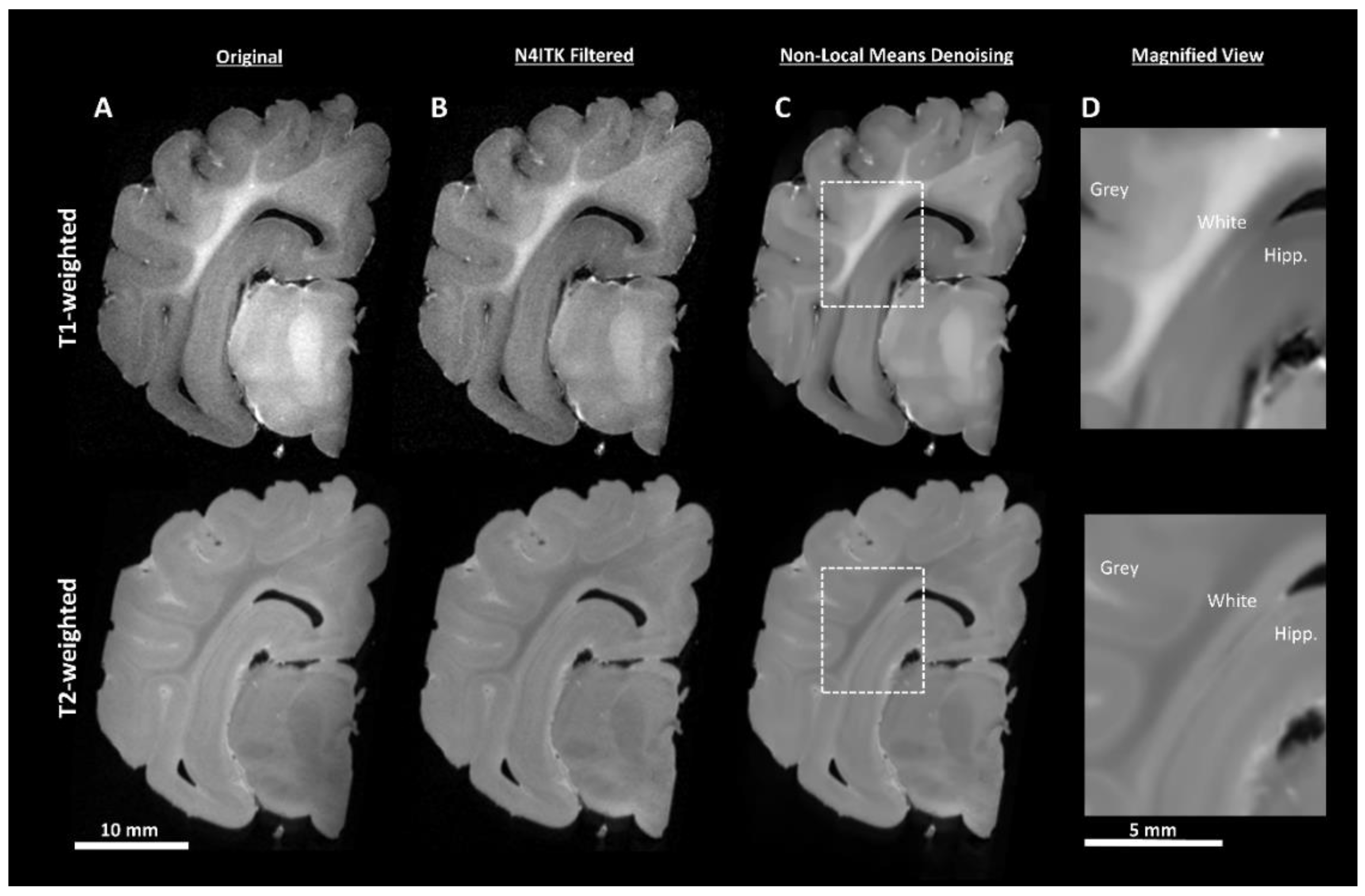 Brainsci 10 00211 g003