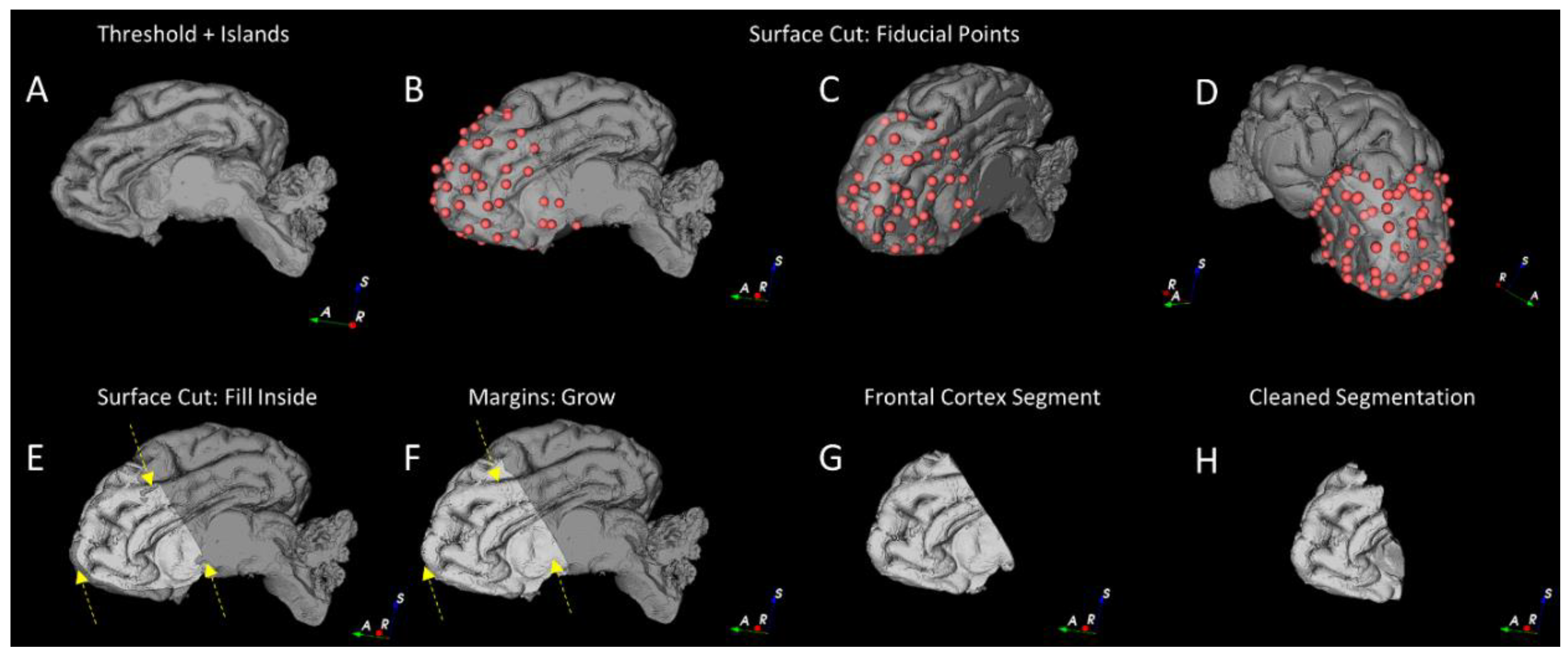 Brainsci 10 00211 g004