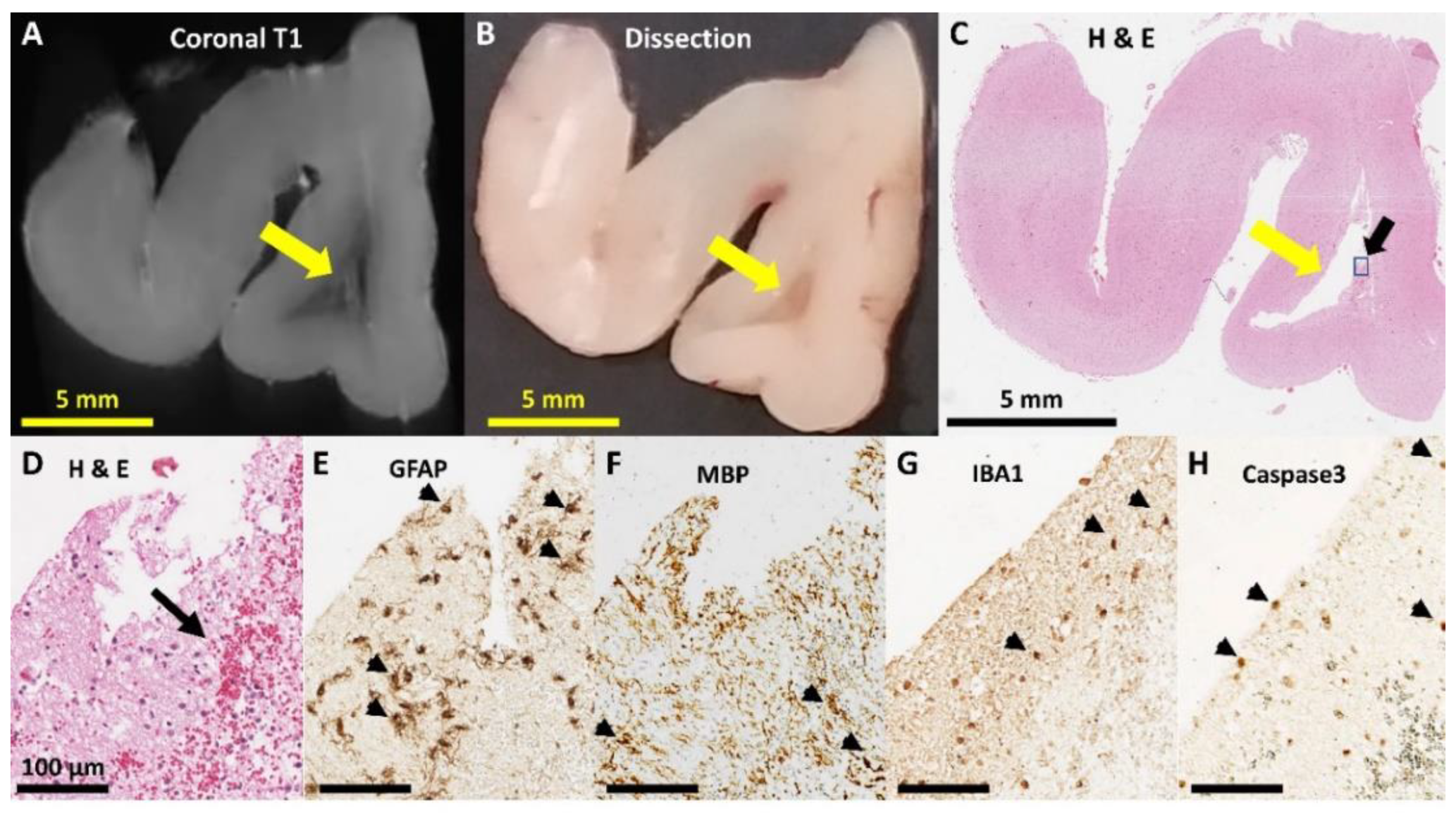 Brainsci 10 00211 g008