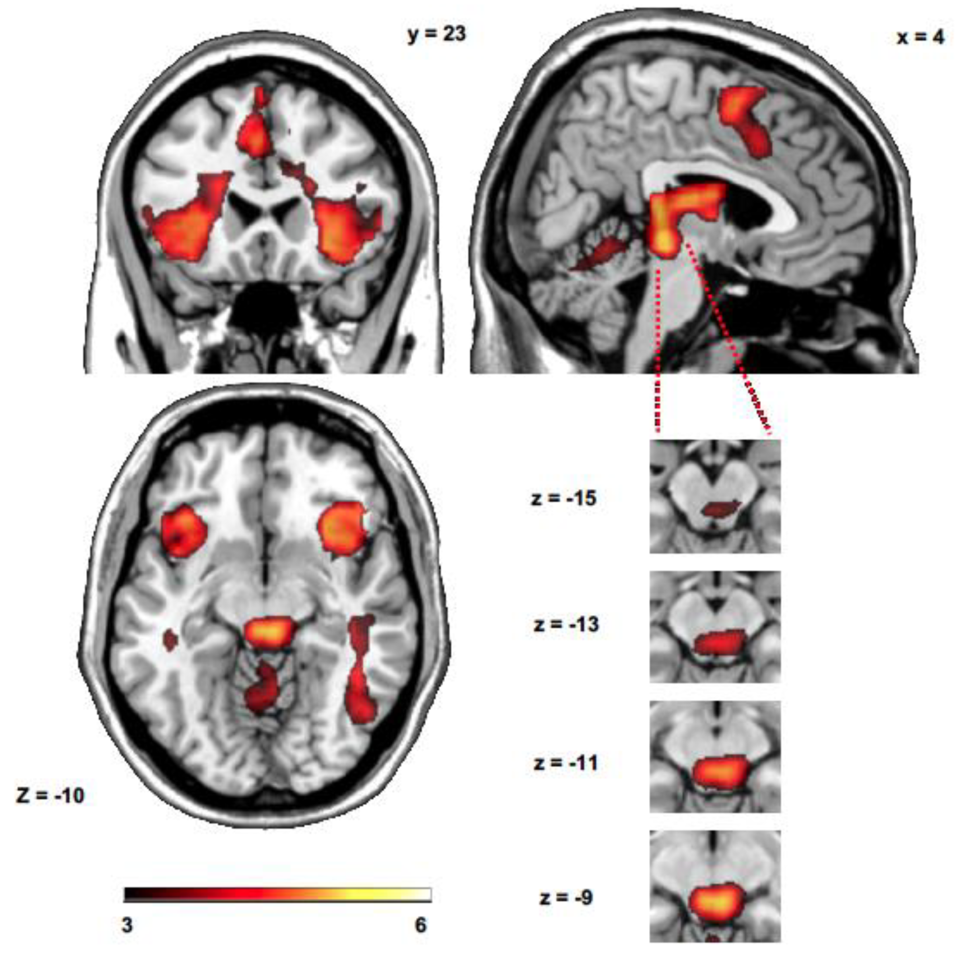 Brainsci 10 00223 g002 Brainsci 10 00223 g002