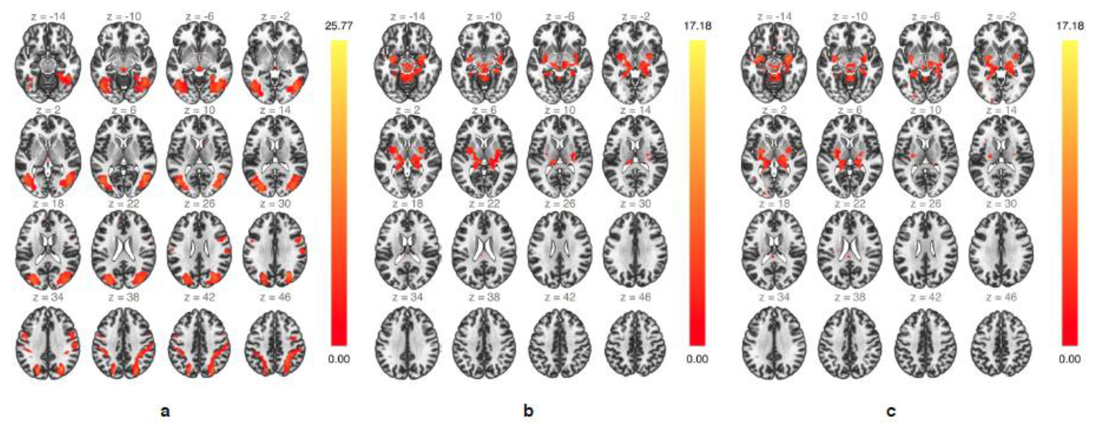 Brainsci 10 00223 g003 Brainsci 10 00223 g003