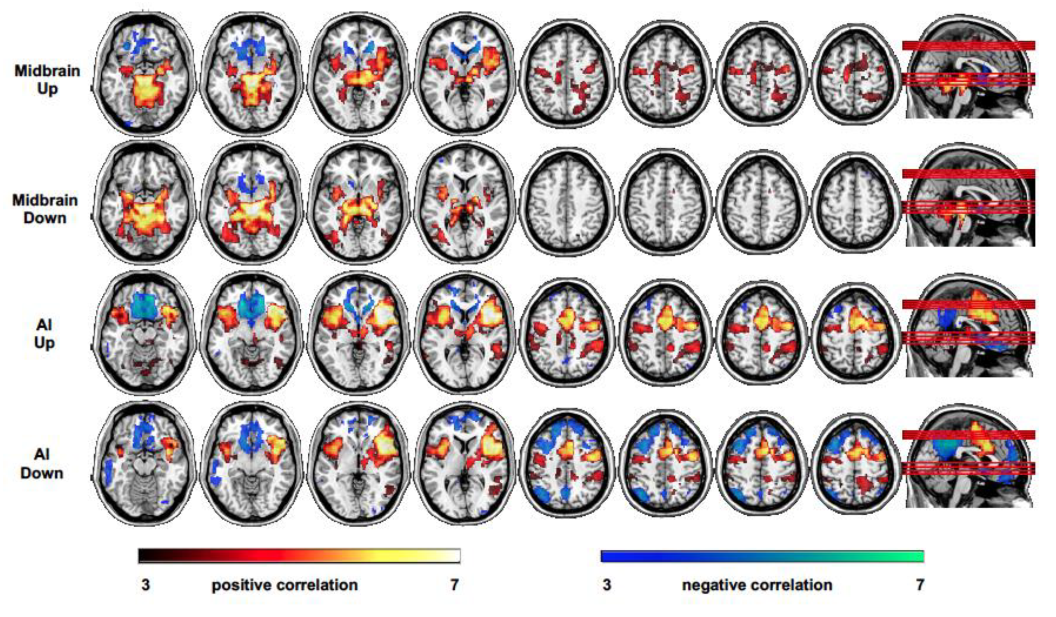 Brainsci 10 00223 g004 Brainsci 10 00223 g004