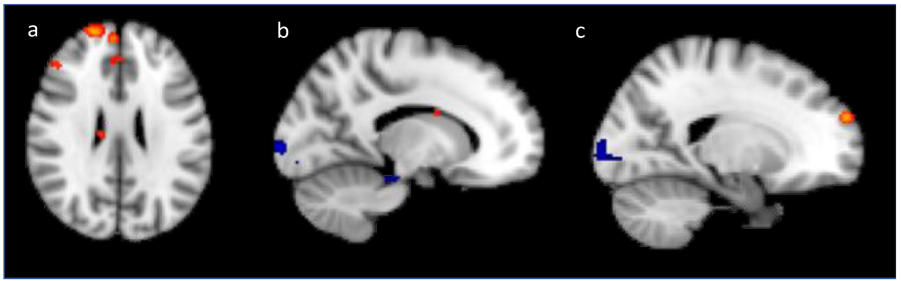 Brainsci 10 00224 g008 Brainsci 10 00224 g008