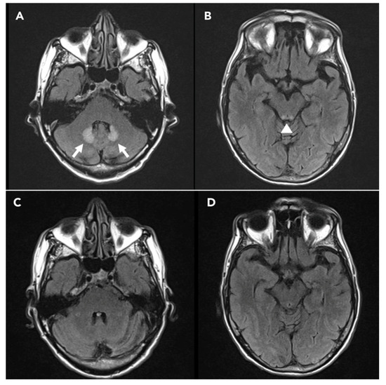 Valium 10 mg for mri
