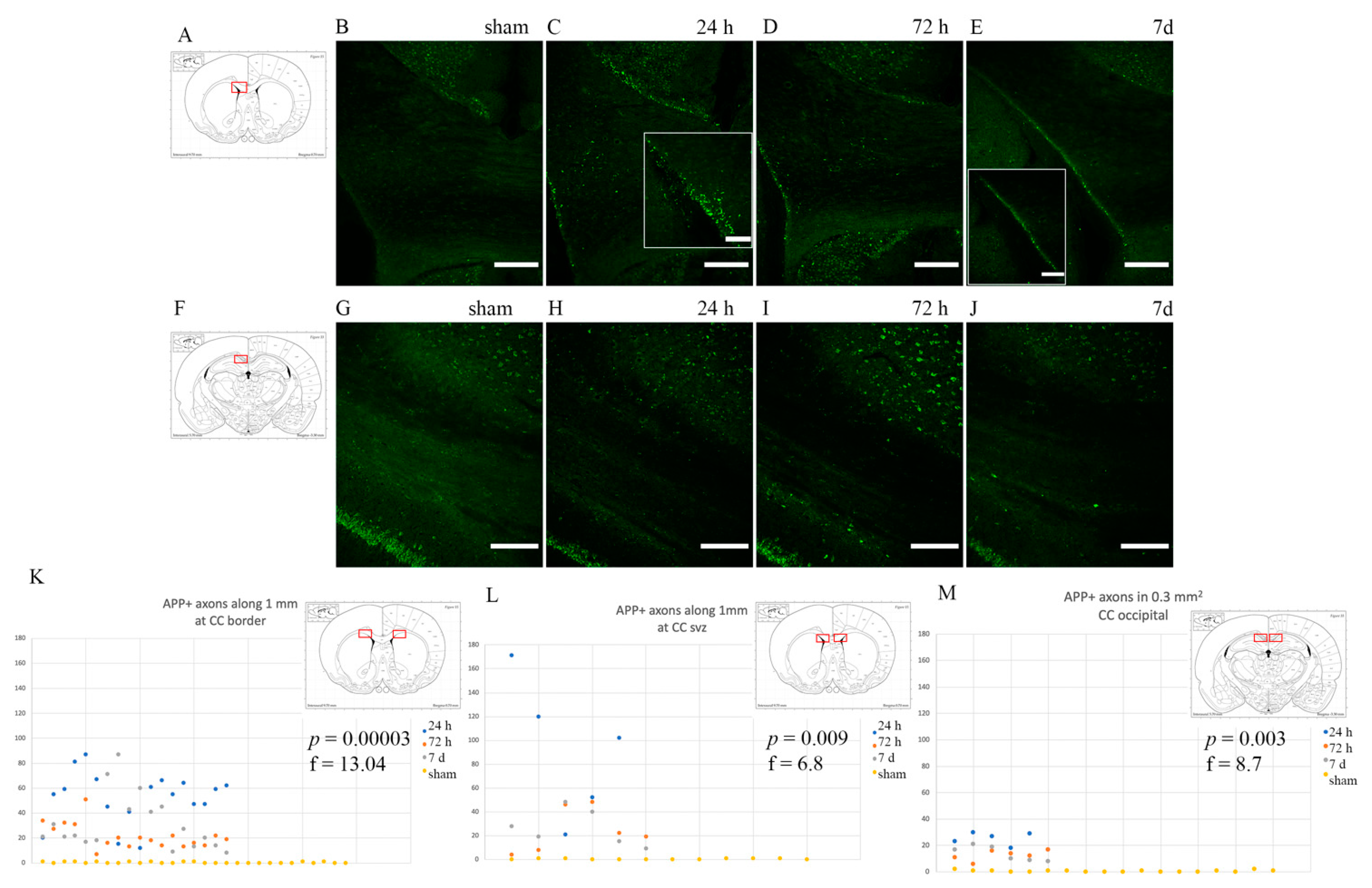Brainsci 10 00229 g003
