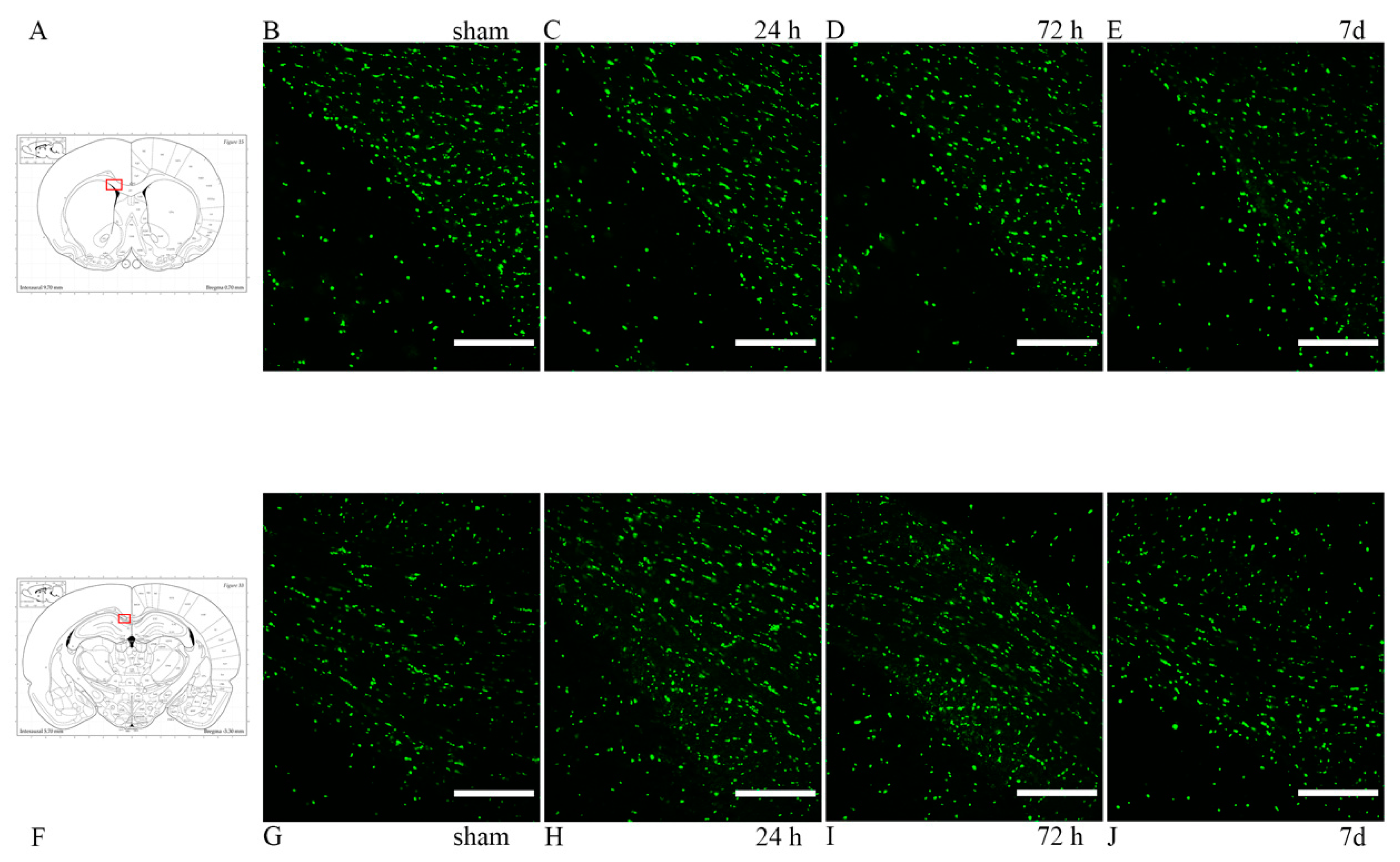 Brainsci 10 00229 g004 Brainsci 10 00229 g004