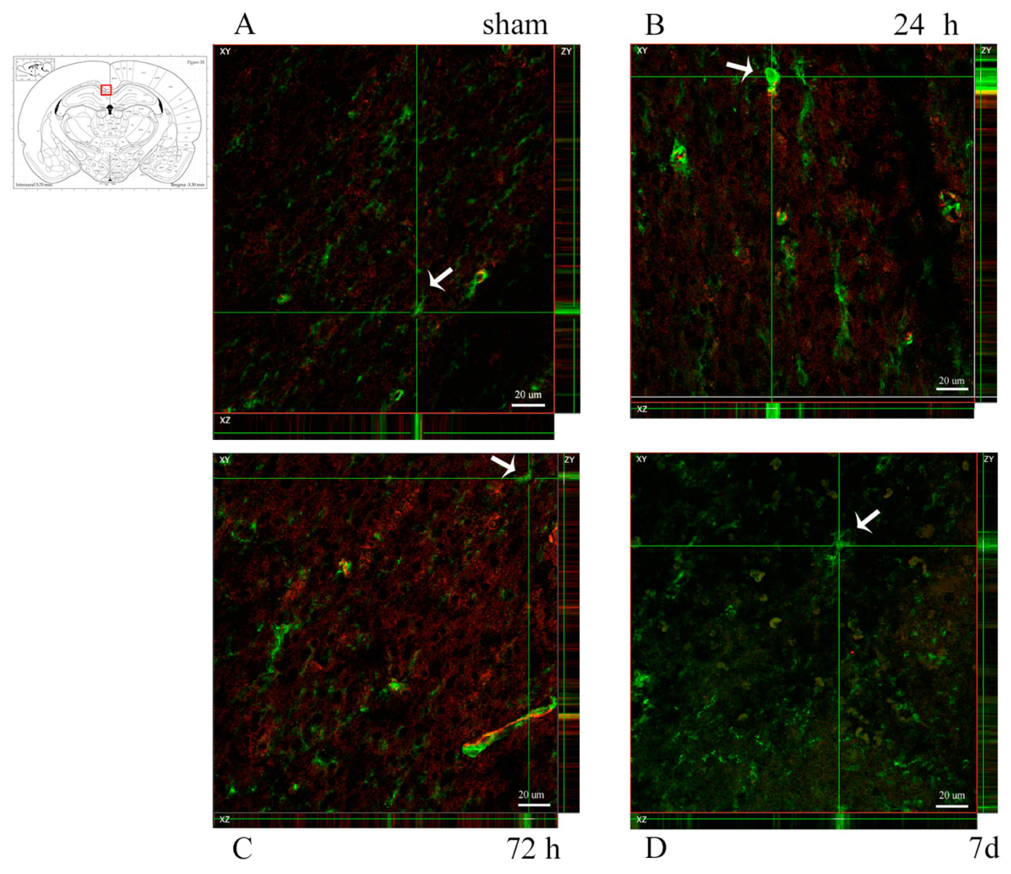 Brainsci 10 00229 g008 Brainsci 10 00229 g008