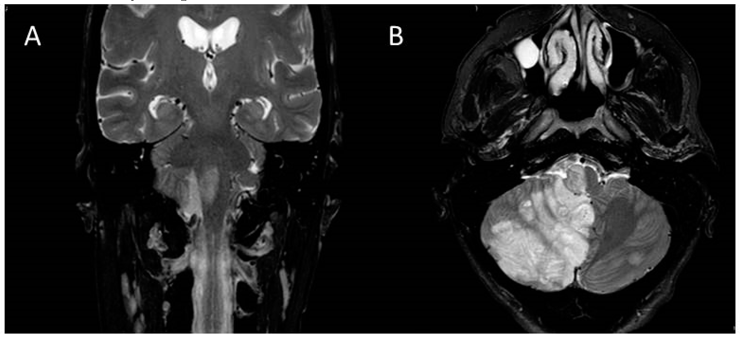Brainsci 10 00256 g001 Brainsci 10 00256 g001