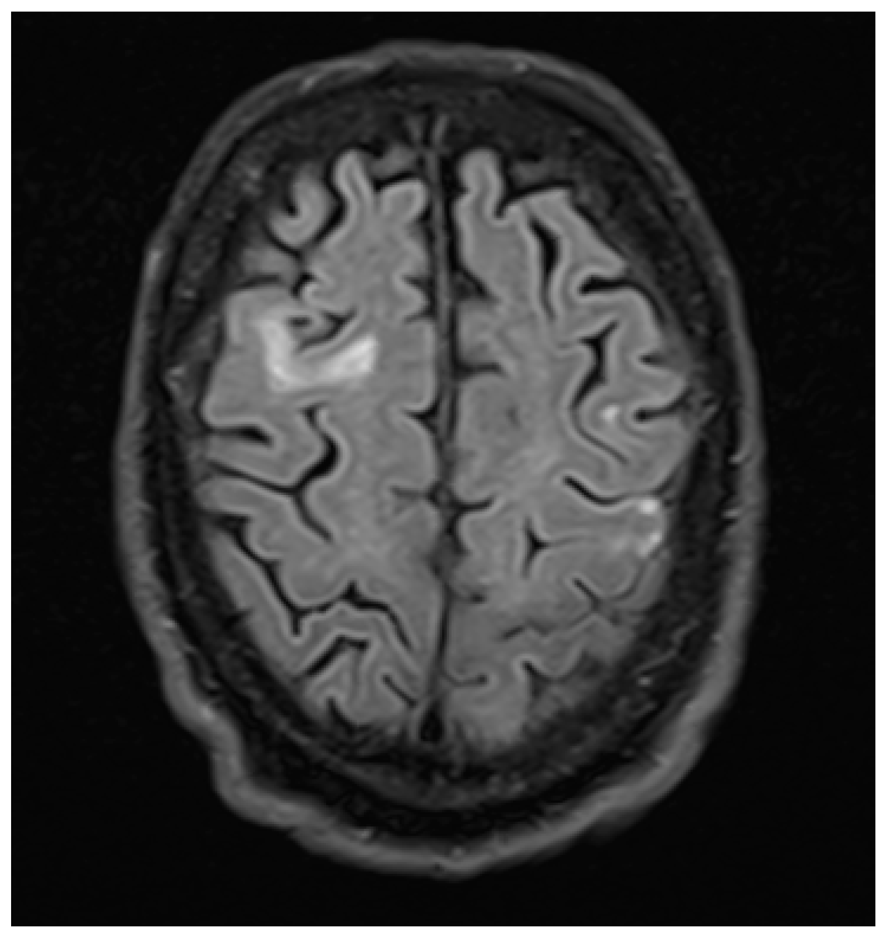 Brainsci 10 00298 g001 Brainsci 10 00298 g001