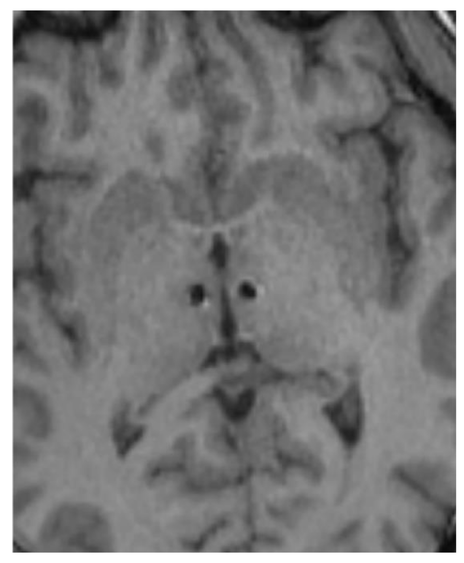 Brainsci 10 00301 g001 Brainsci 10 00301 g001