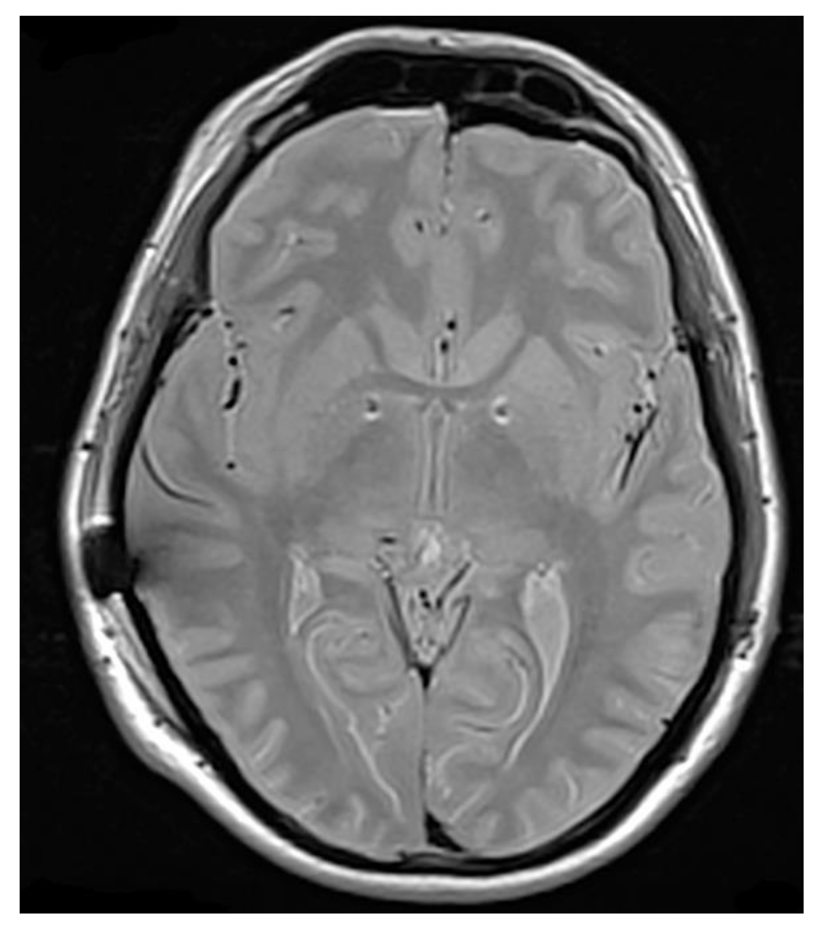 Brainsci 10 00301 g002 Brainsci 10 00301 g002