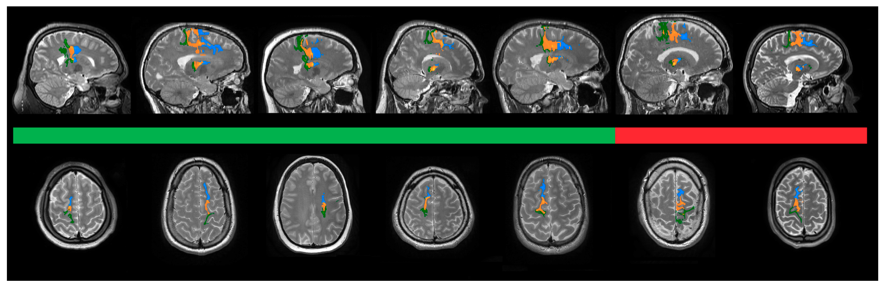 Brainsci 10 00302 g004 Brainsci 10 00302 g004