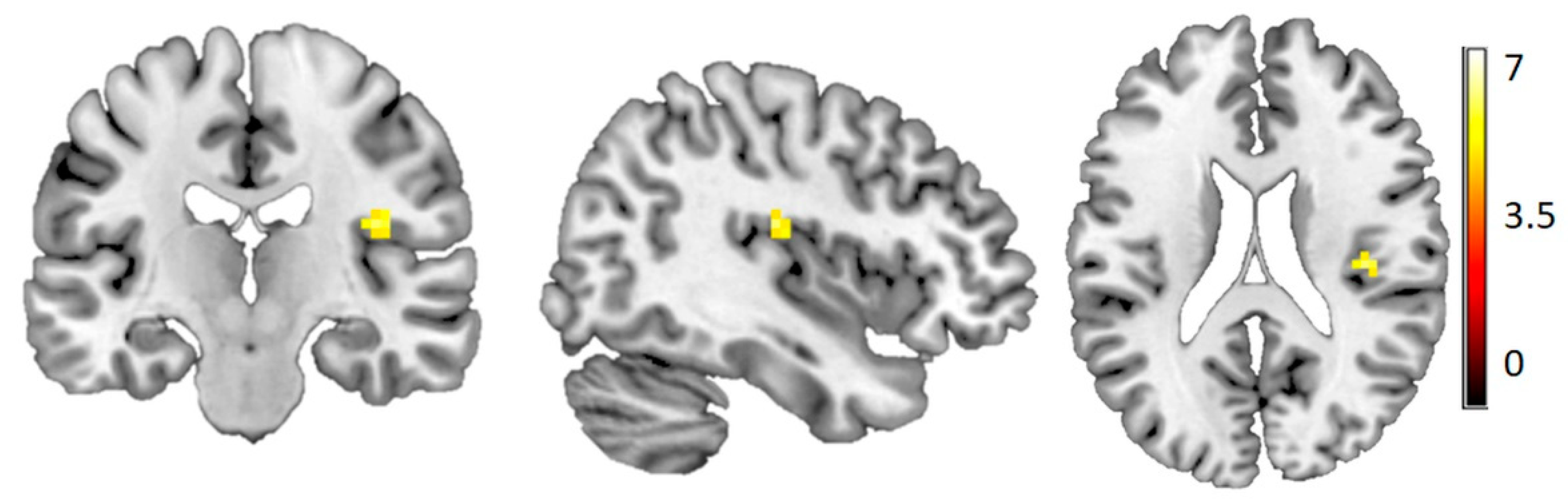 Brainsci 10 00306 g002