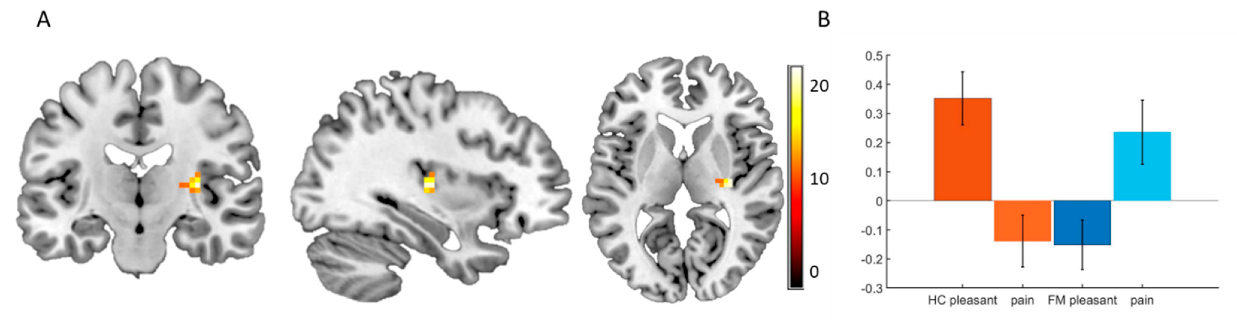 Brainsci 10 00306 g003
